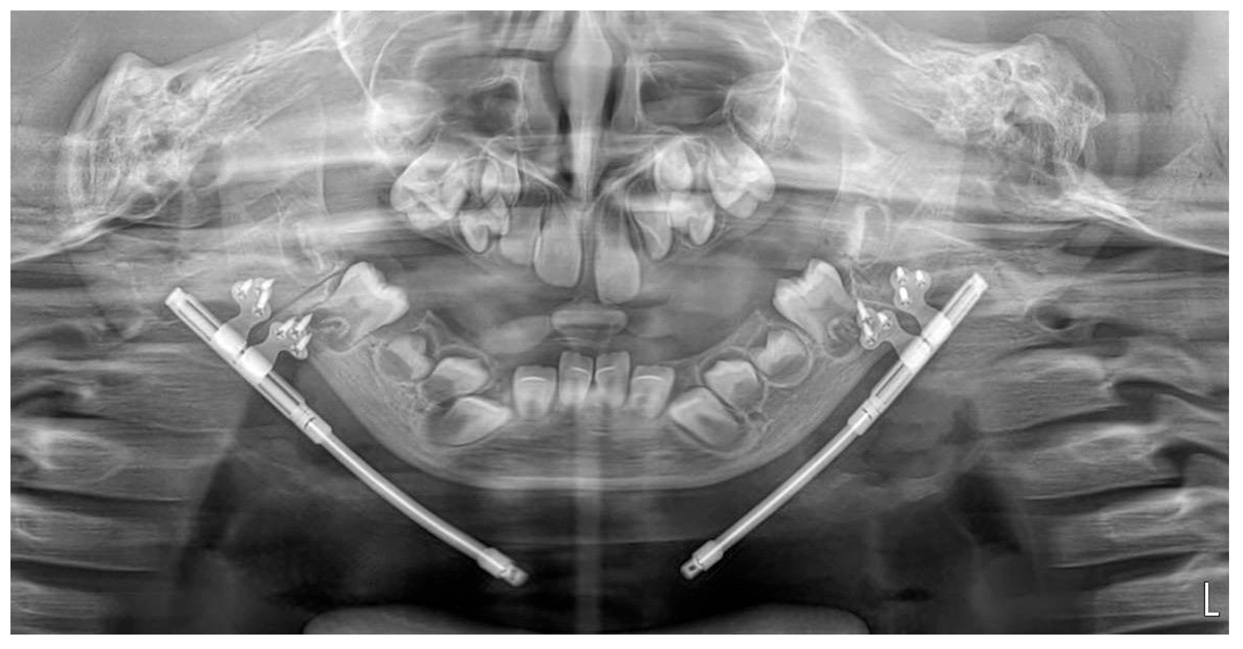 Pediatrrep 18 00006 g005 Pediatrrep 18 00006 g005