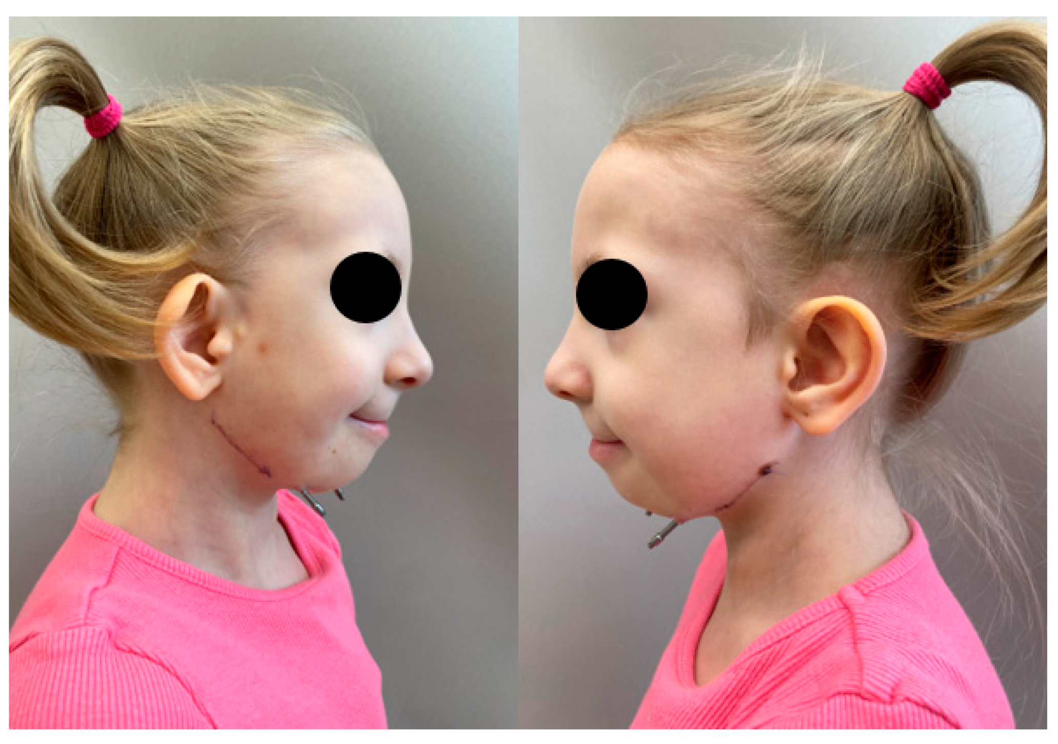 Pediatrrep 18 00006 g006 Pediatrrep 18 00006 g006