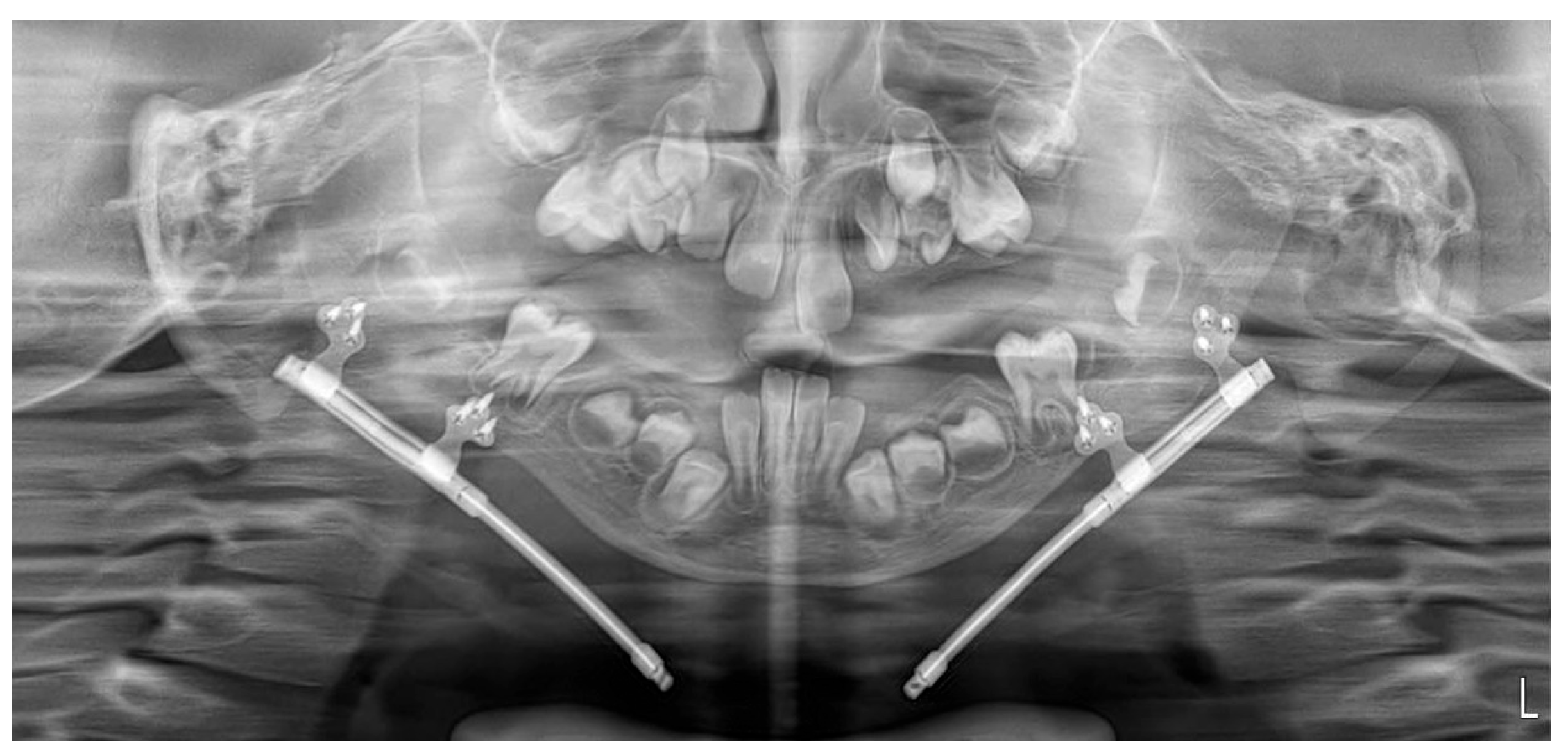 Pediatrrep 18 00006 g007 Pediatrrep 18 00006 g007