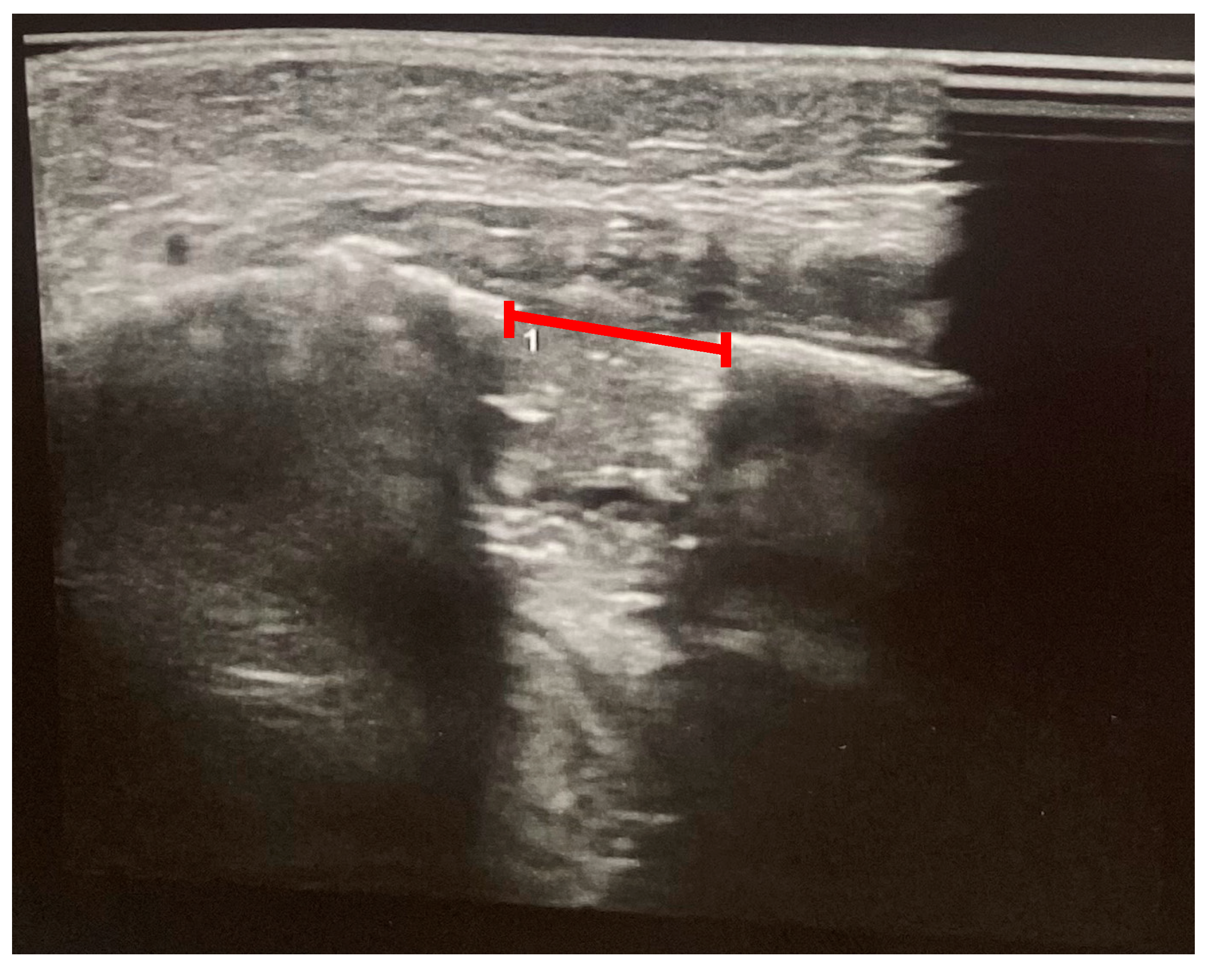 Pediatrrep 18 00006 g008 Pediatrrep 18 00006 g008