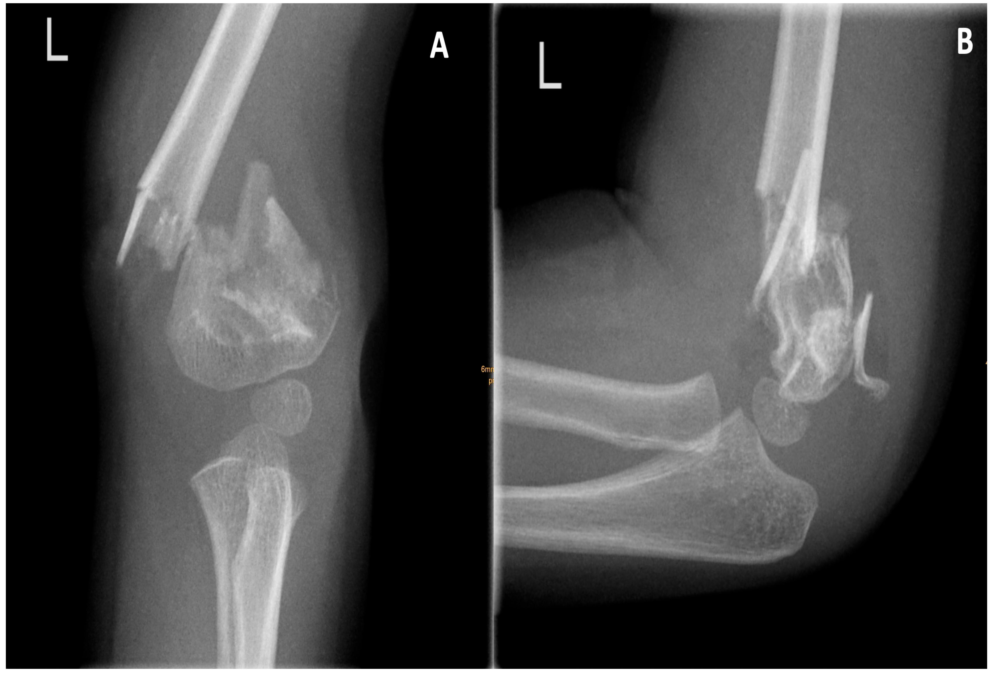 Pediatrrep 18 00015 g001 Pediatrrep 18 00015 g001