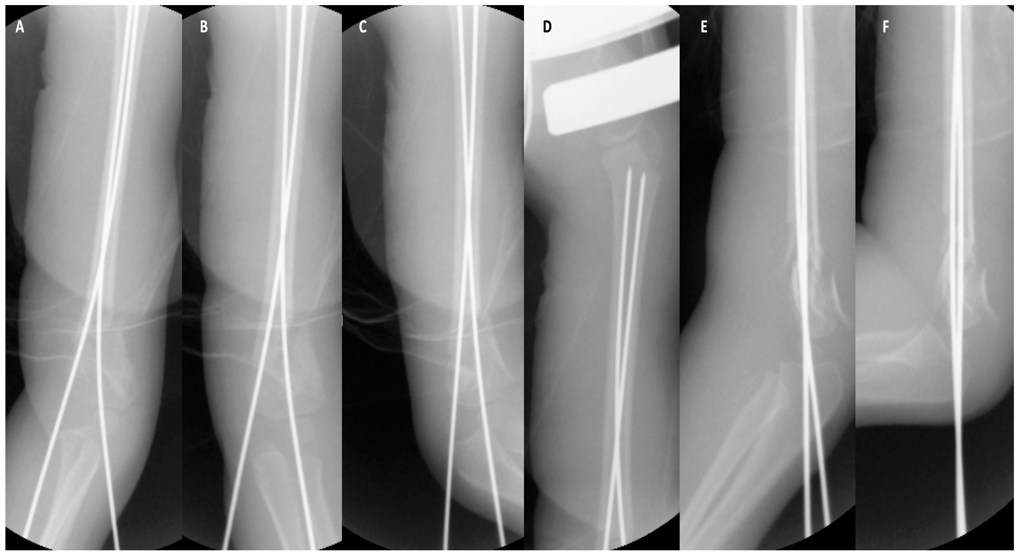 Pediatrrep 18 00015 g002 Pediatrrep 18 00015 g002