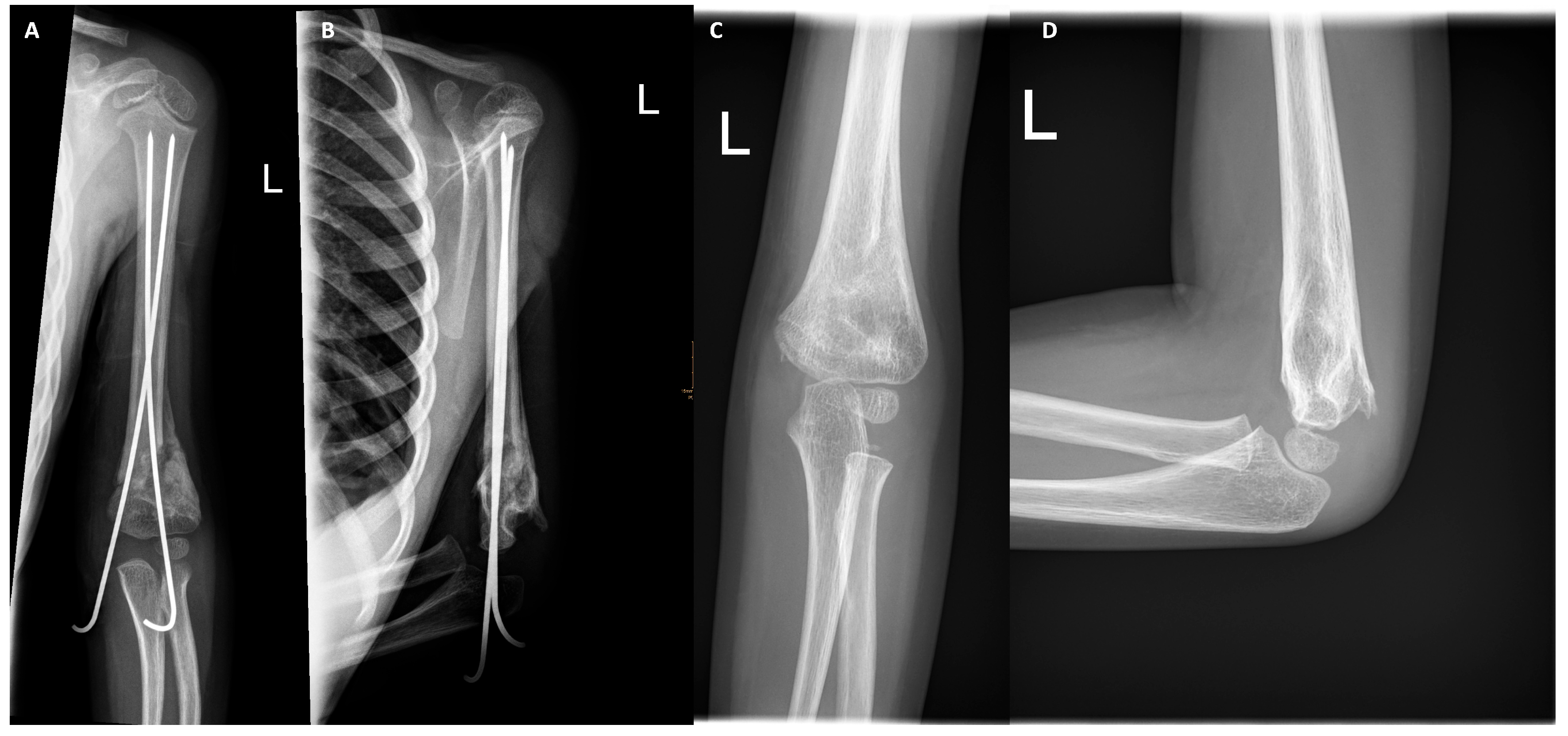 Pediatrrep 18 00015 g003 Pediatrrep 18 00015 g003