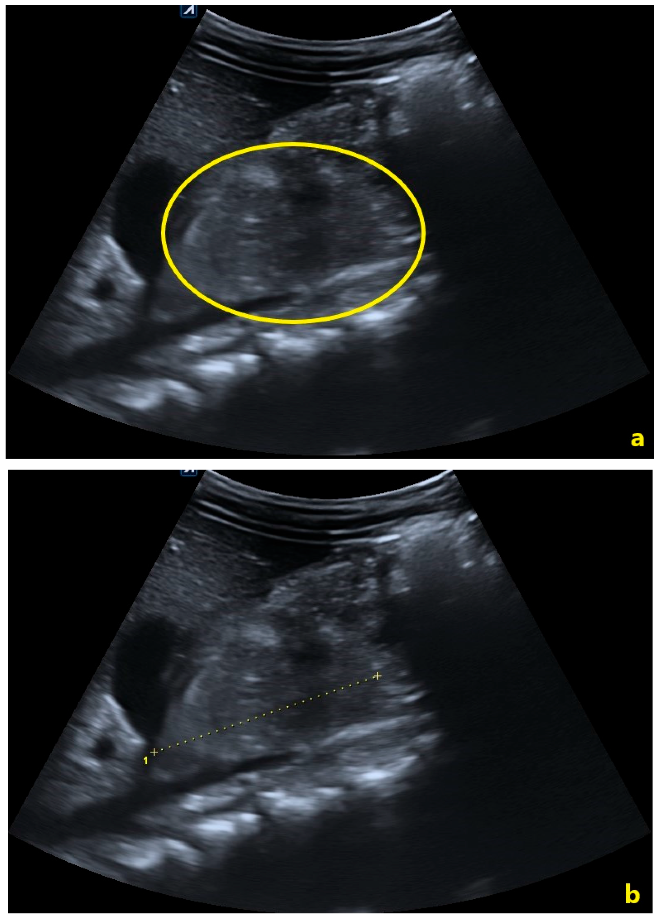 Pediatrrep 18 00042 g003