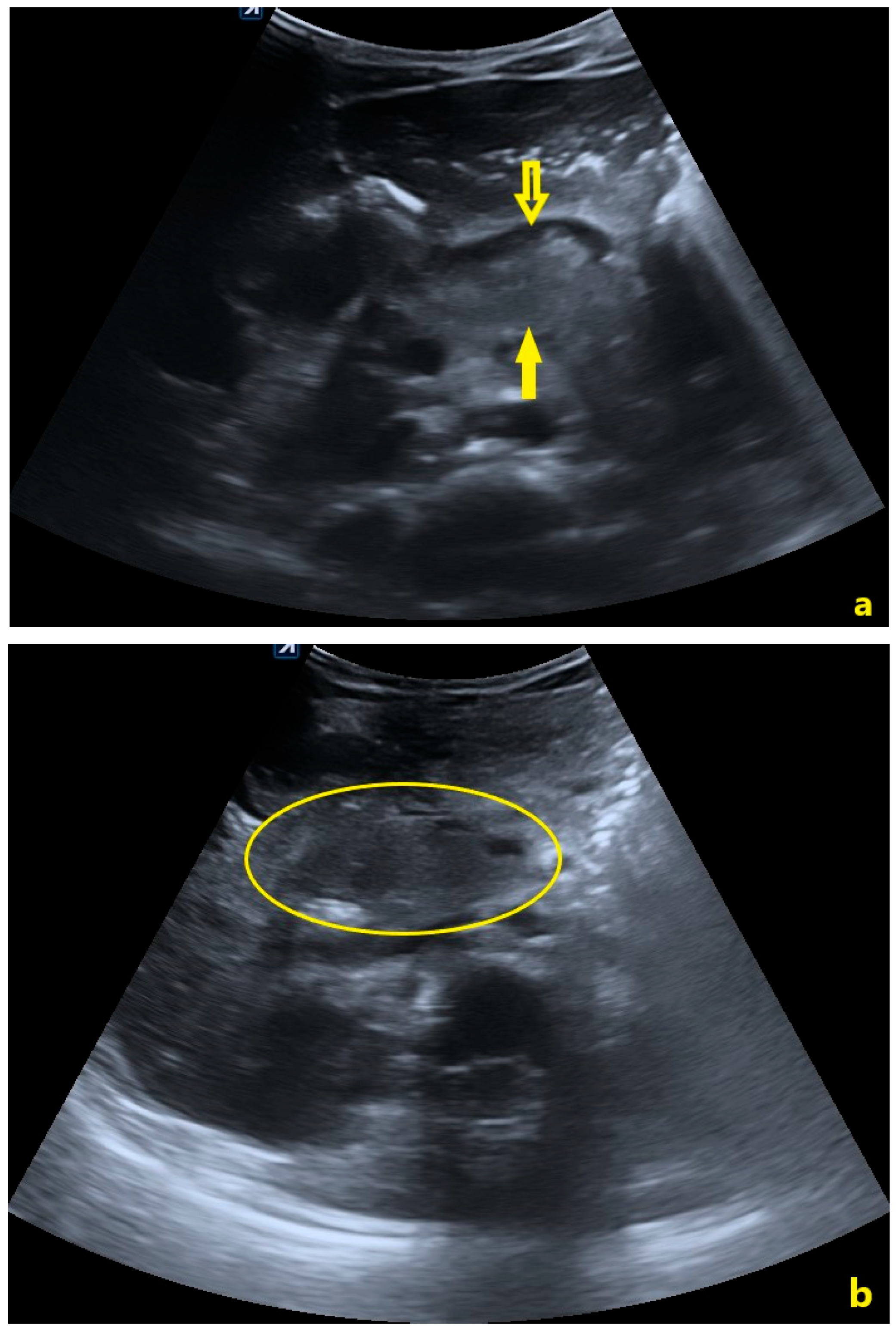 Pediatrrep 18 00042 g004a
