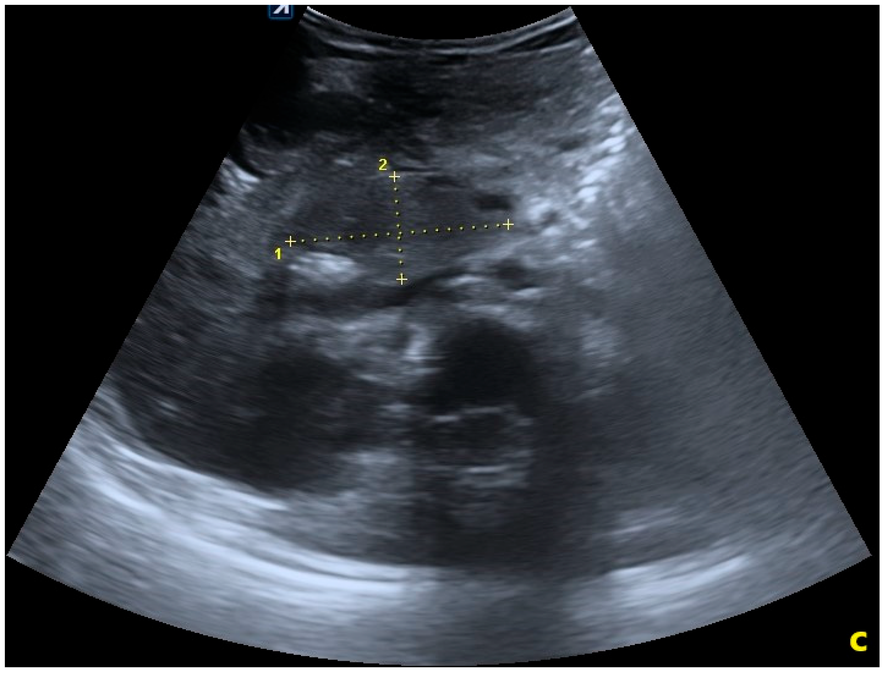 Pediatrrep 18 00042 g004b