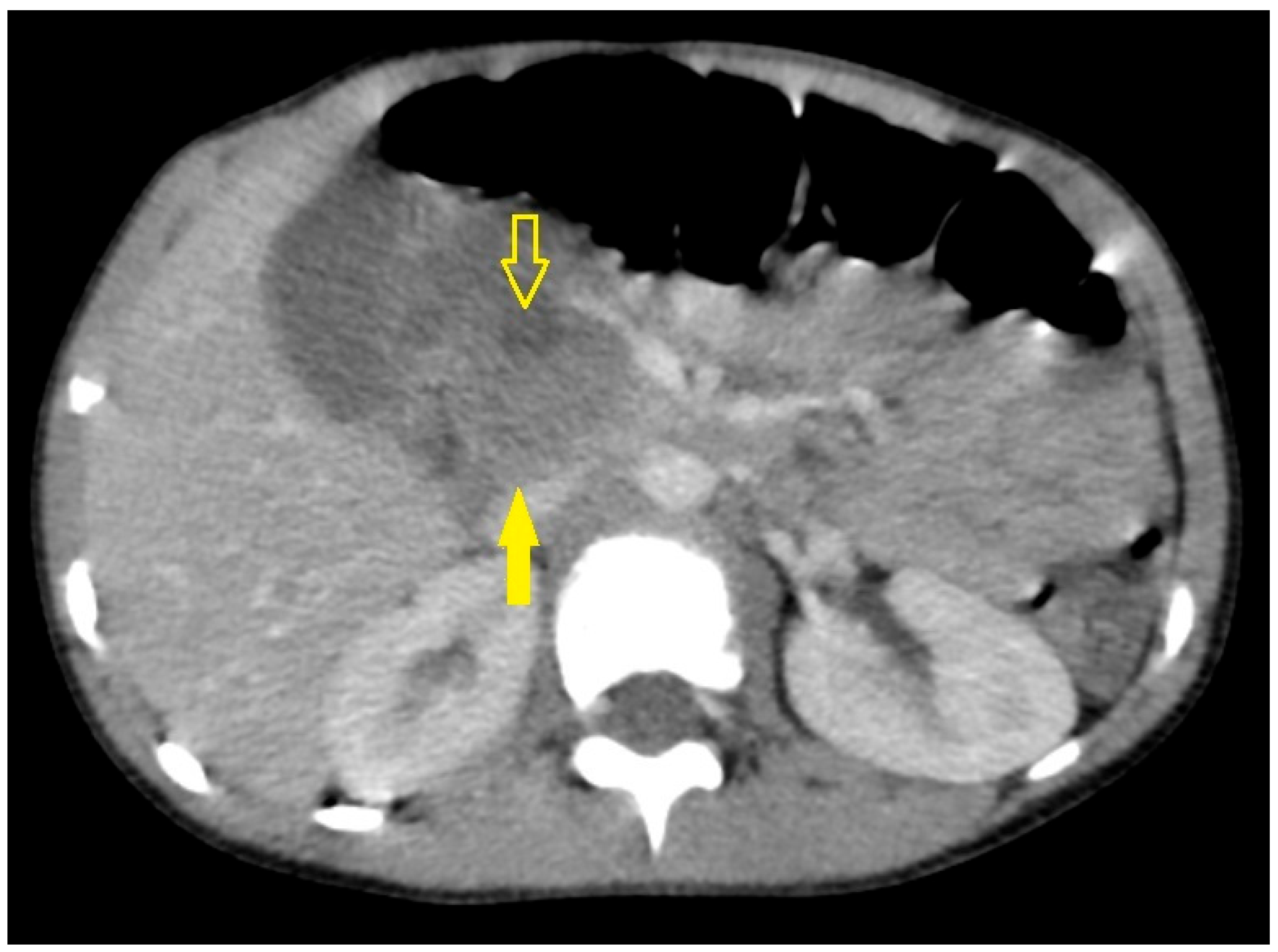 Pediatrrep 18 00042 g005