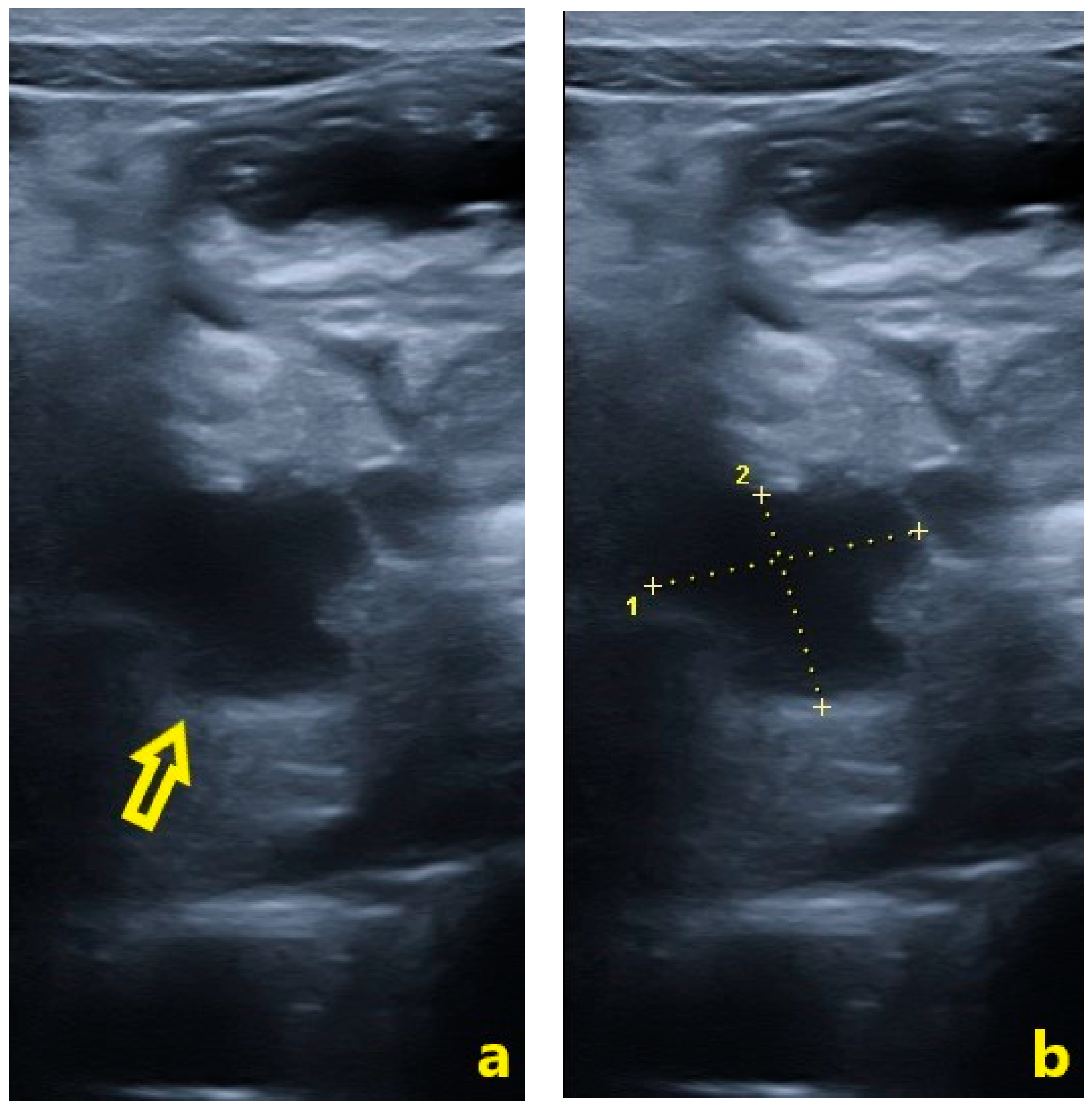 Pediatrrep 18 00042 g007
