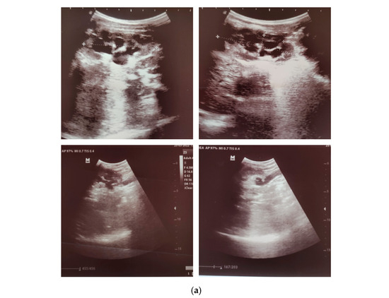 Pediatrrep 18 00049 g001a Pediatrrep 18 00049 g001a