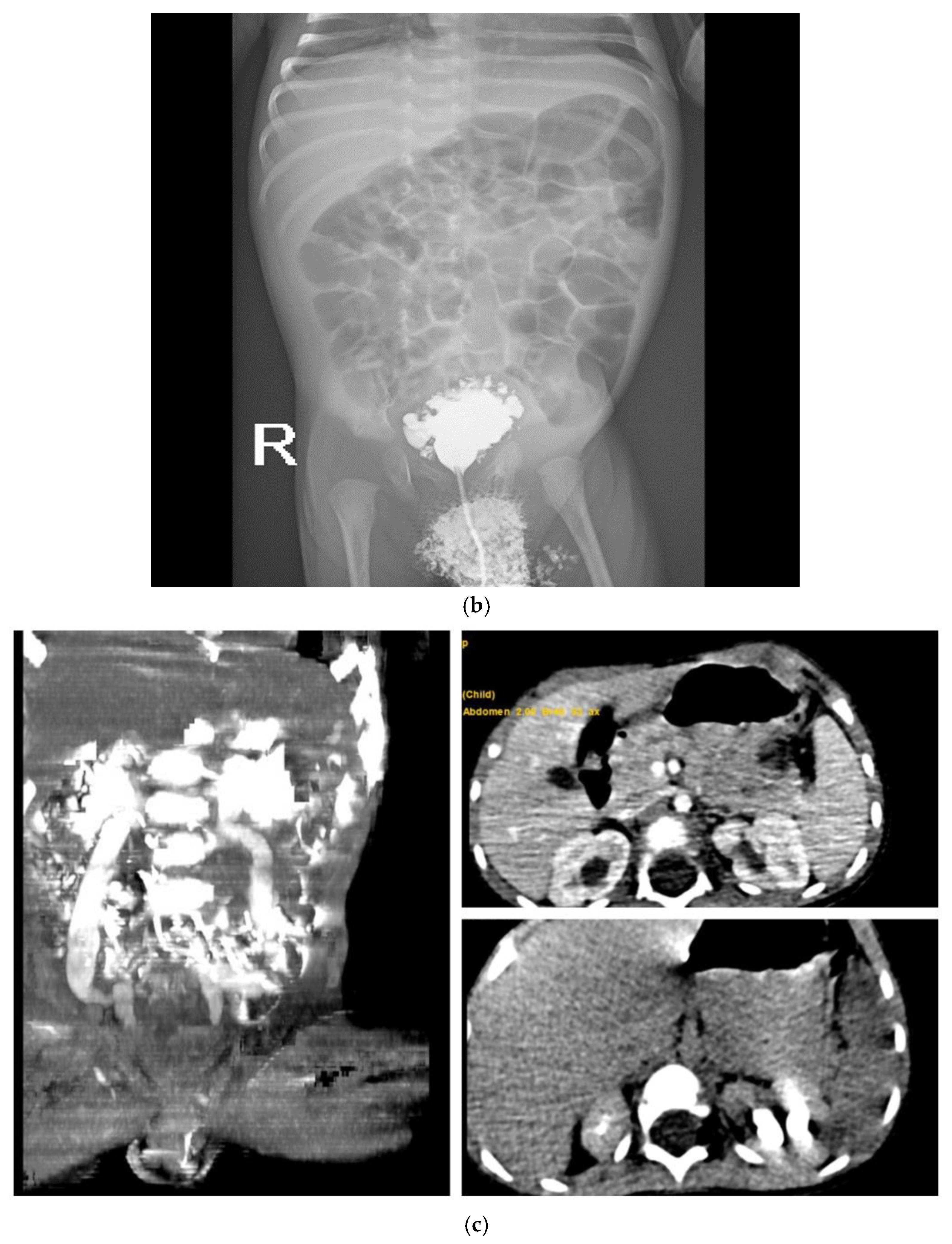 Pediatrrep 18 00049 g001b Pediatrrep 18 00049 g001b