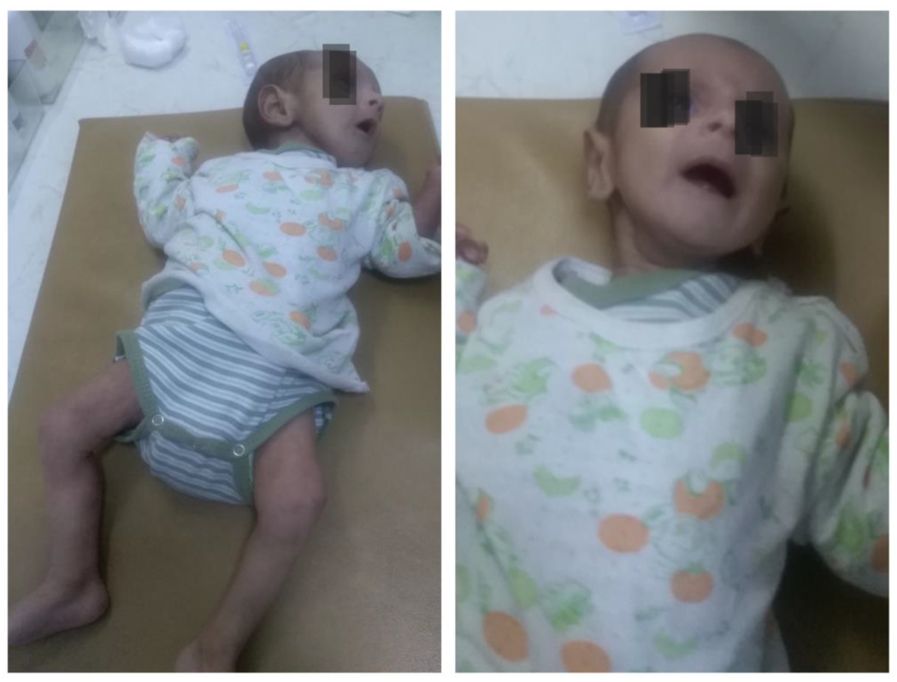 Pediatrrep 18 00049 g002 Pediatrrep 18 00049 g002
