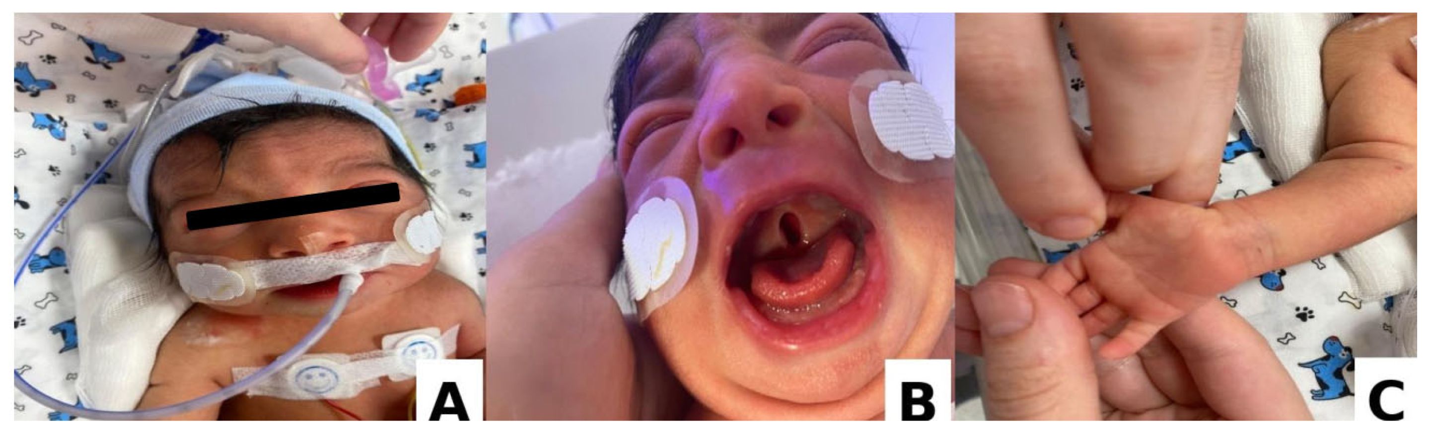 Pediatrrep 18 00076 g001 Pediatrrep 18 00076 g001
