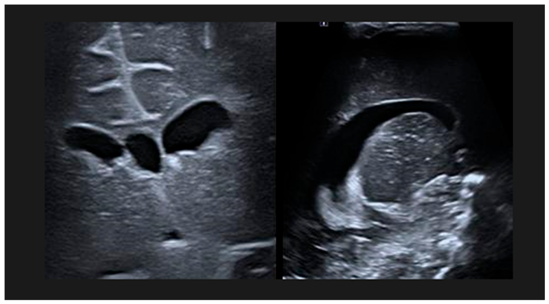 Pediatrrep 18 00076 g002 Pediatrrep 18 00076 g002