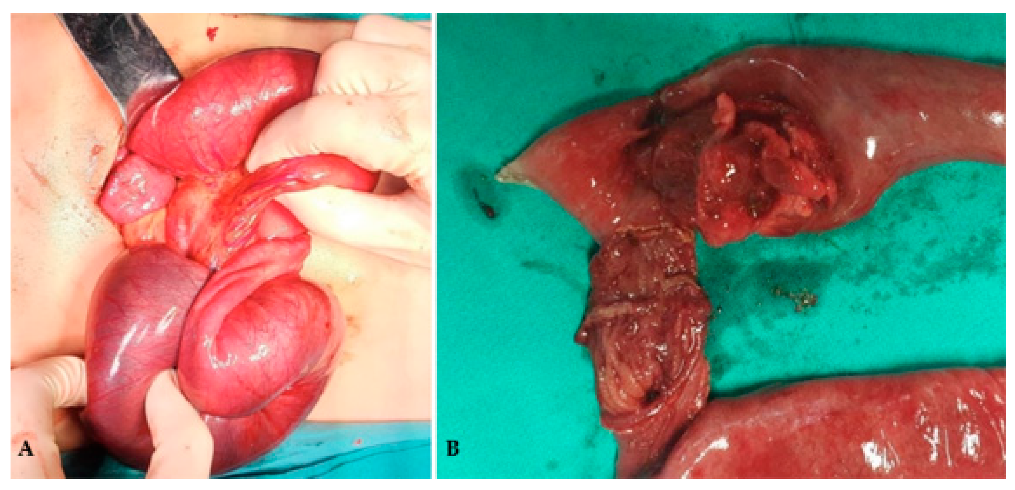 Pediatrrep 18 00139 g001 Pediatrrep 18 00139 g001