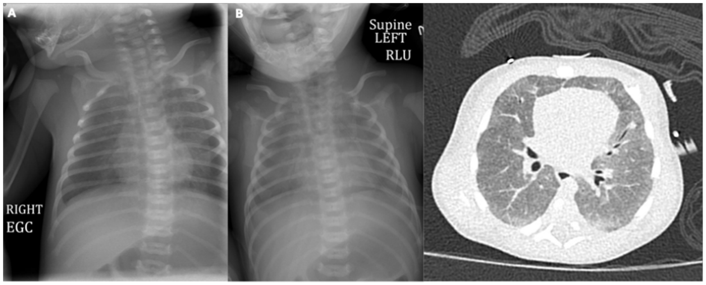 Pediatrrep 18 00141 g001 Pediatrrep 18 00141 g001