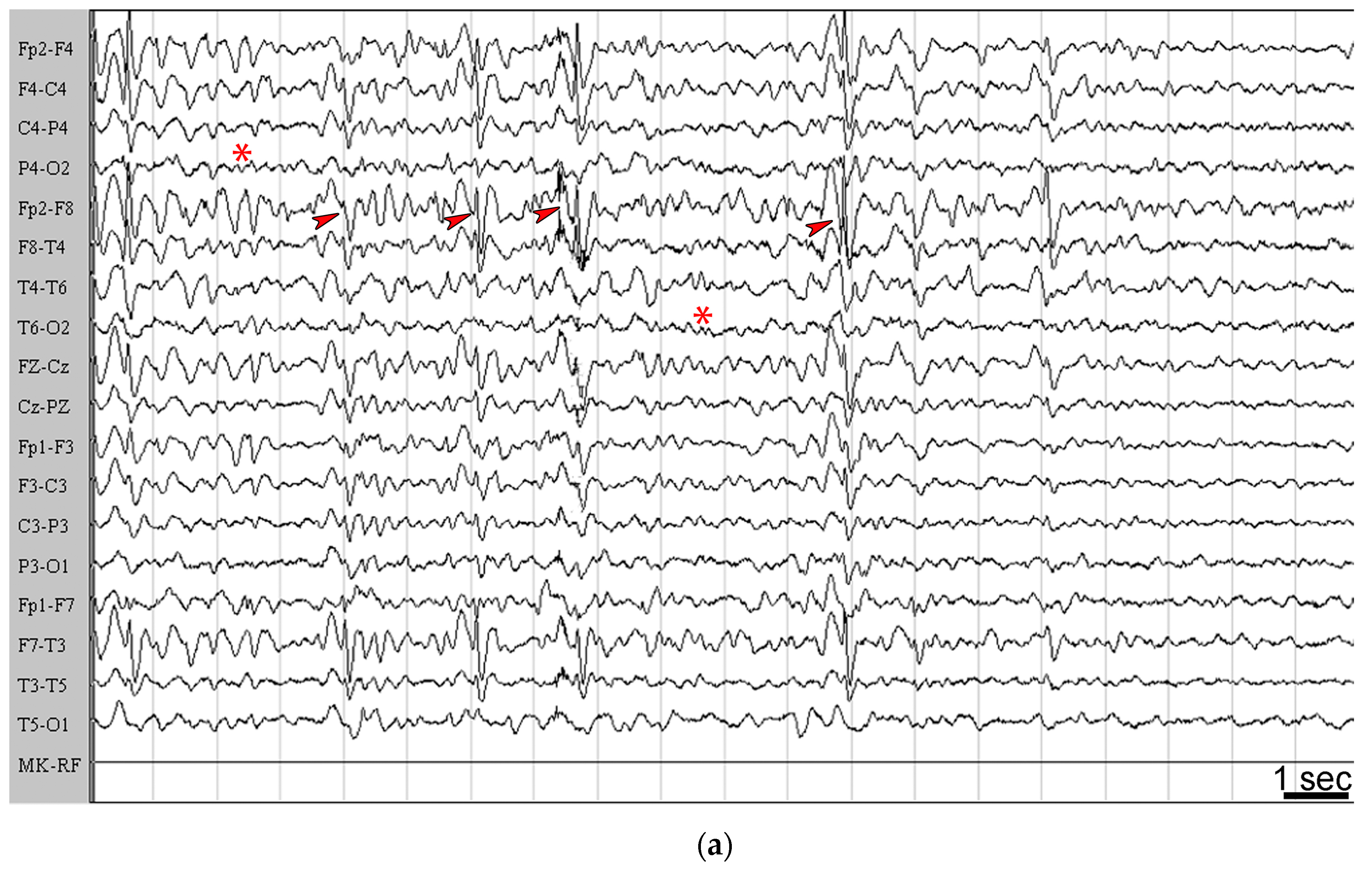 Pharmaceuticals 10 00082 g005a Pharmaceuticals 10 00082 g005a
