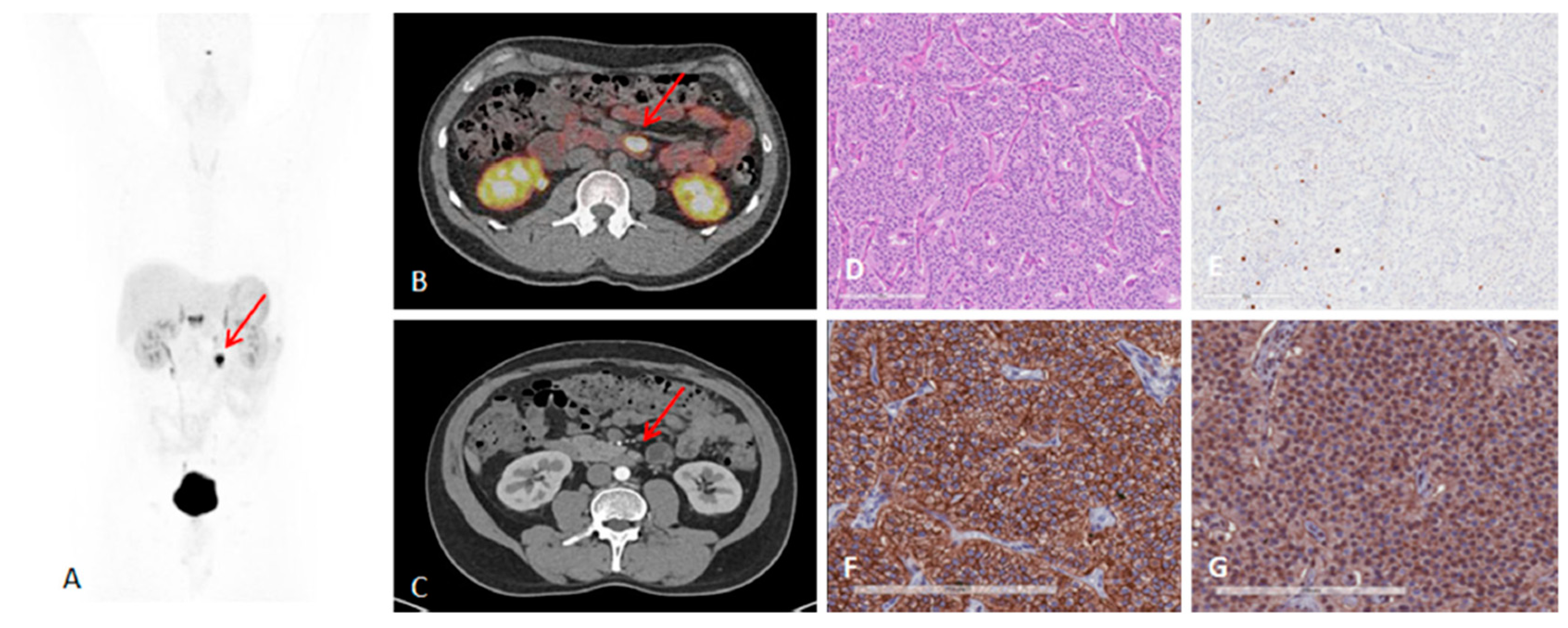 Pharmaceuticals 13 00039 g004