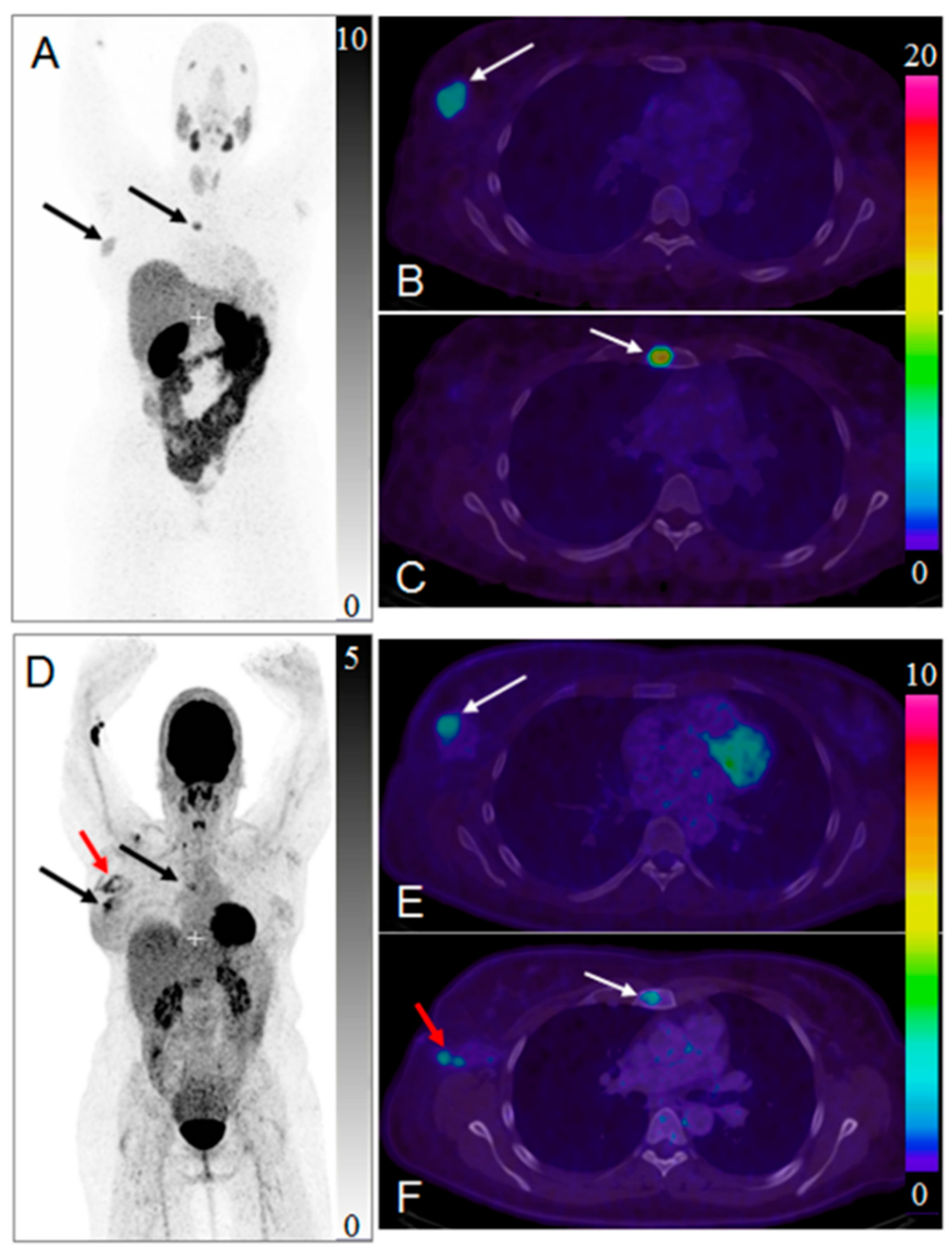 Pharmaceuticals 13 00039 g012