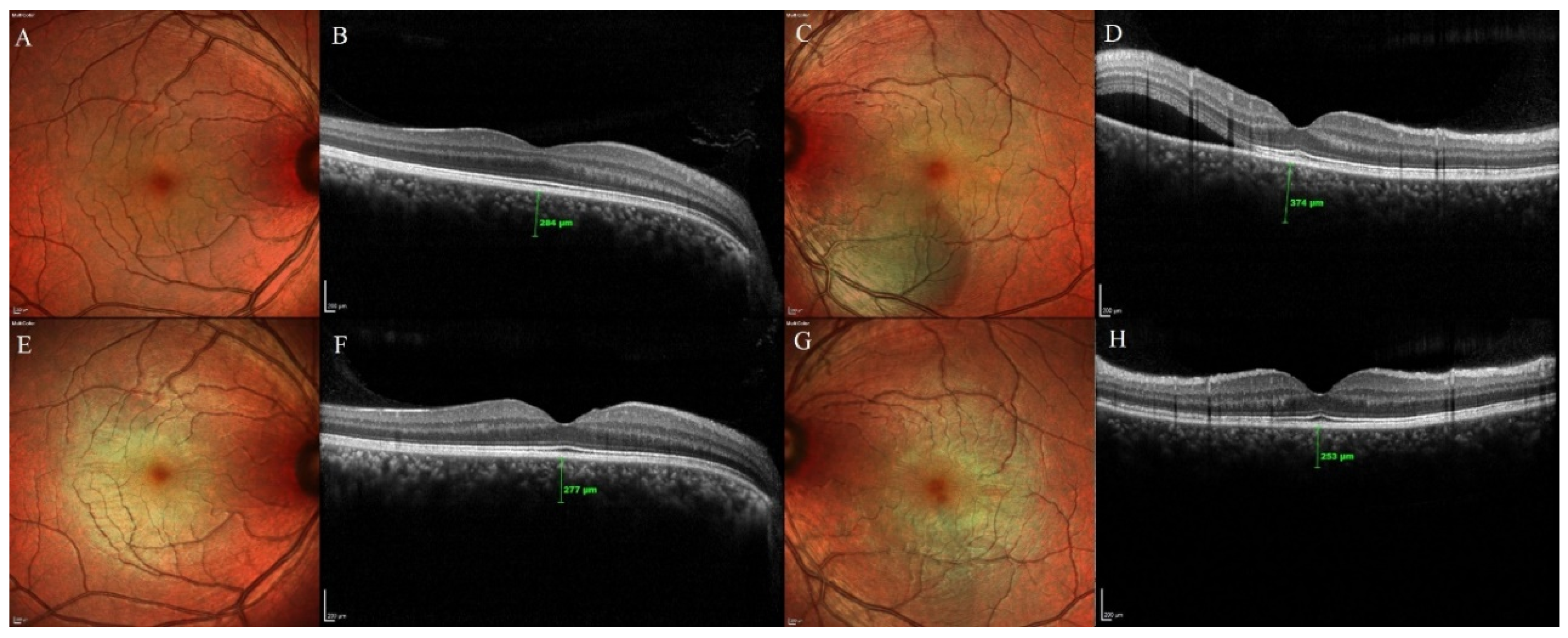 Pharmaceuticals 13 00170 g002