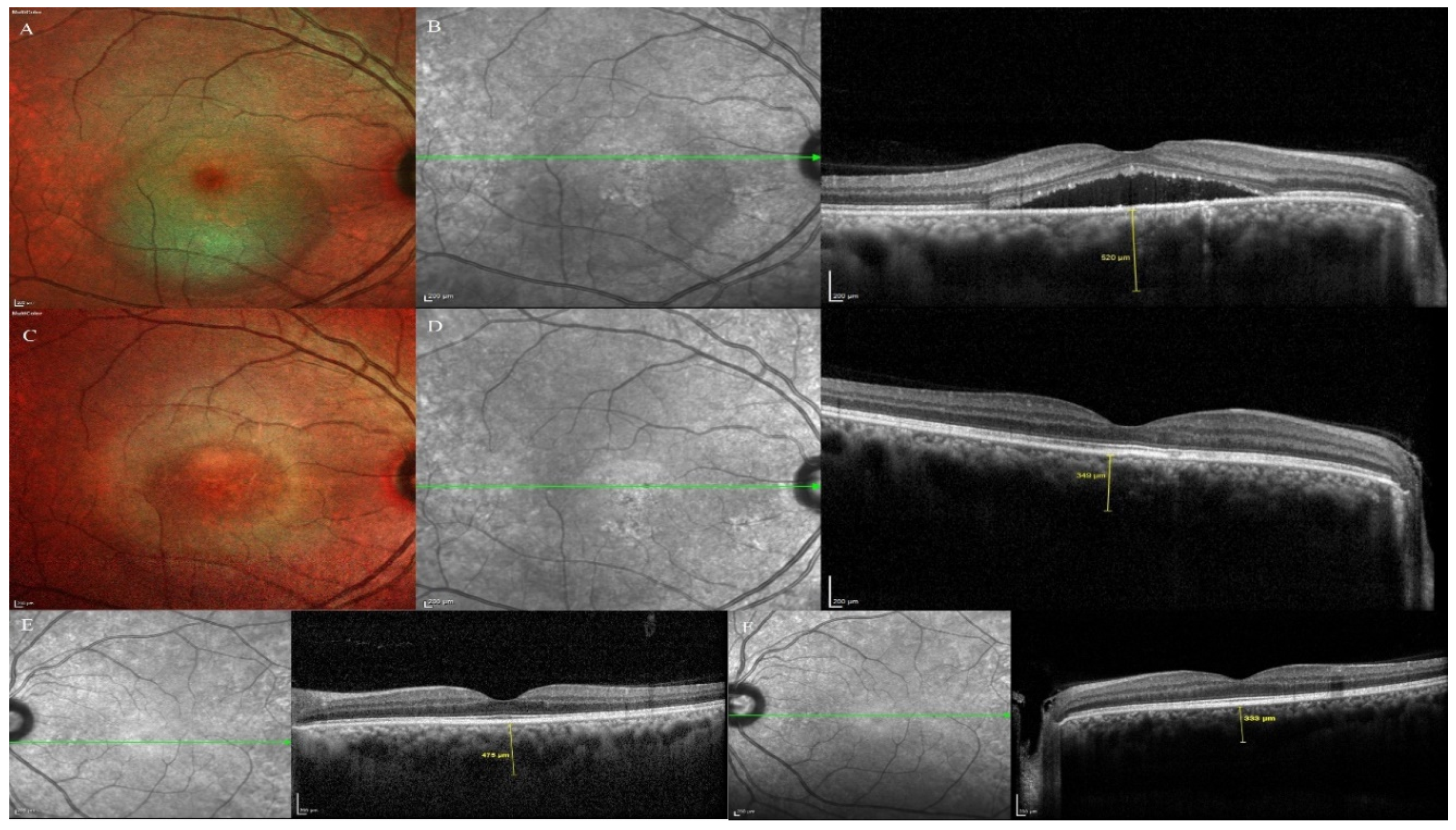Pharmaceuticals 13 00170 g003