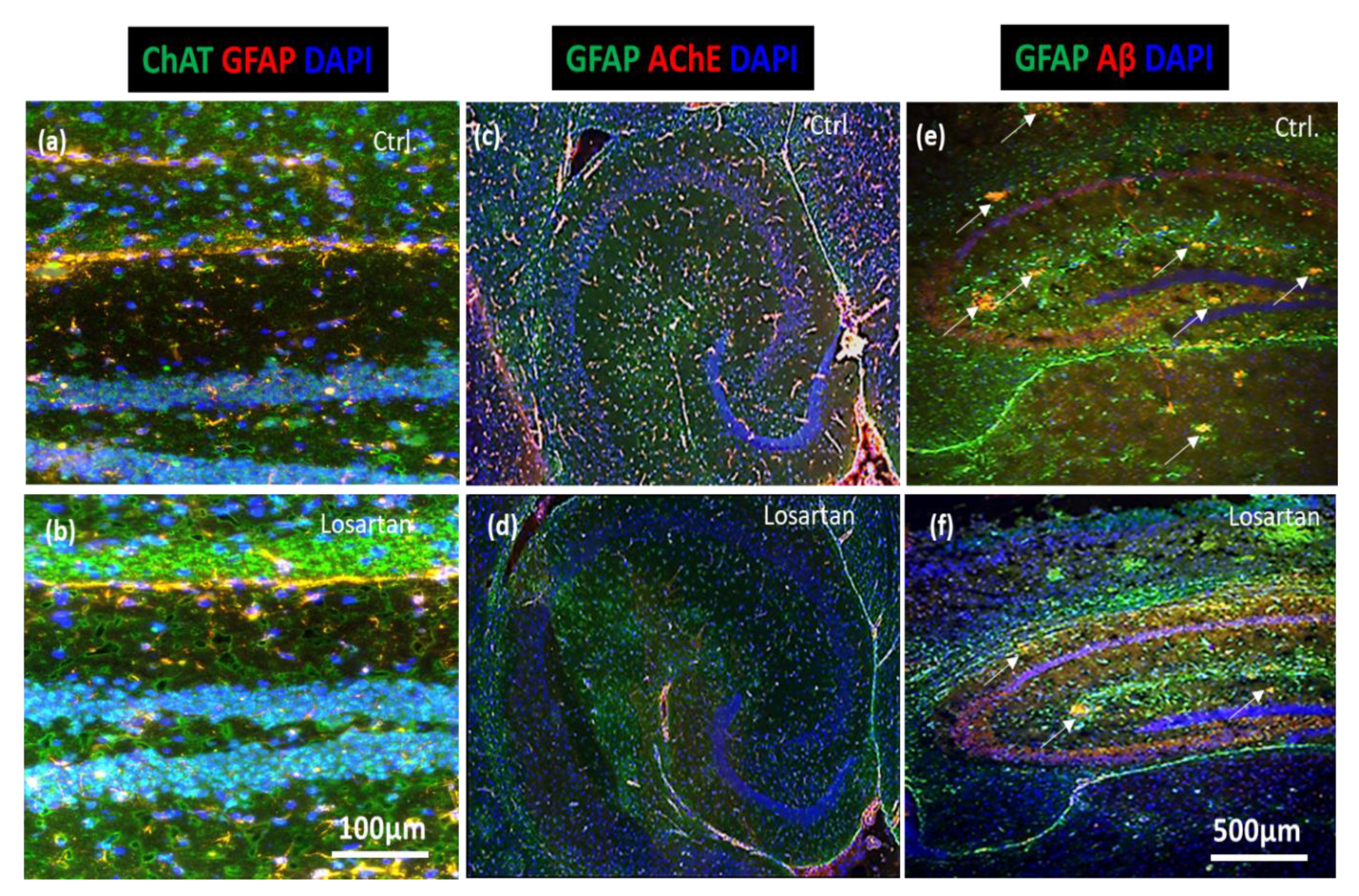 Pharmaceuticals 14 00166 g005