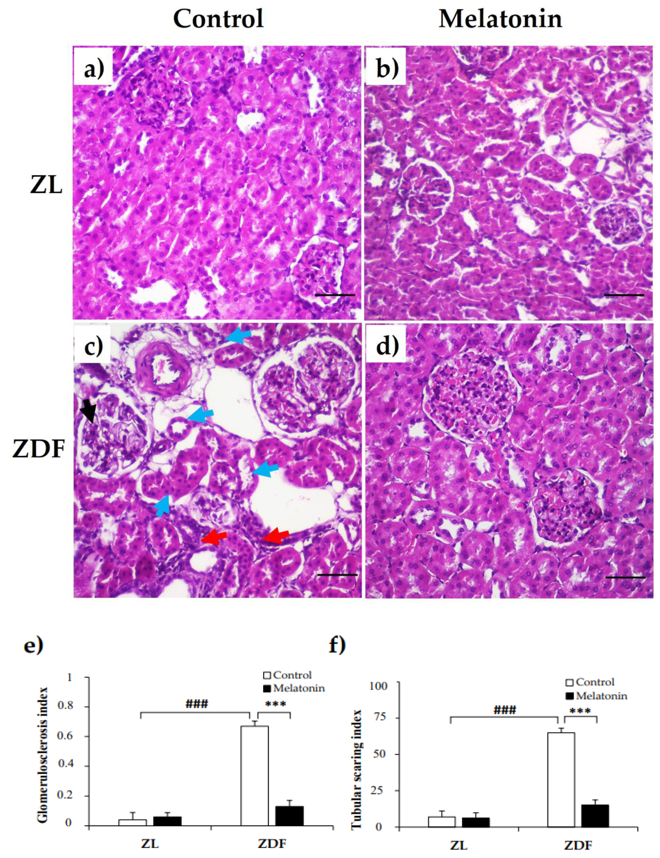 Pharmaceuticals 14 00232 g003