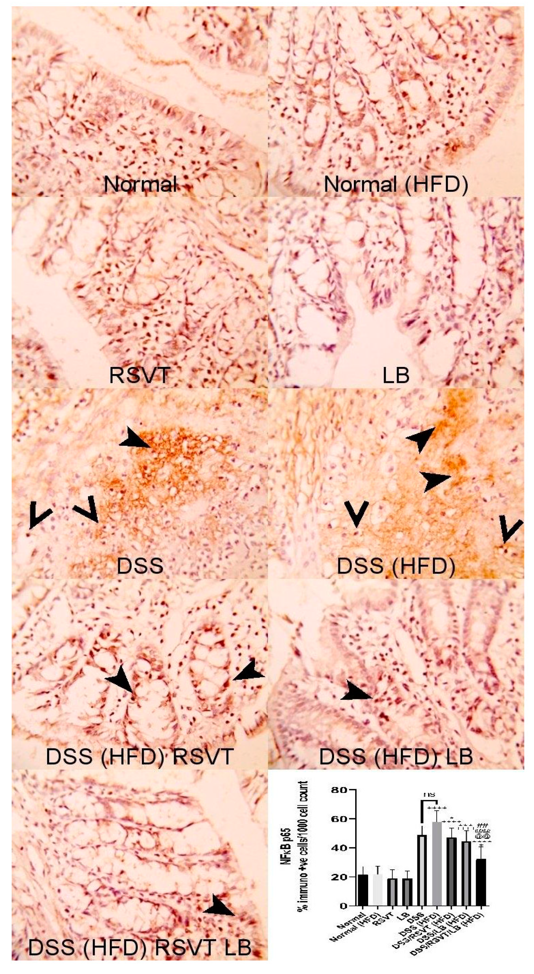 Pharmaceuticals 14 00341 g003