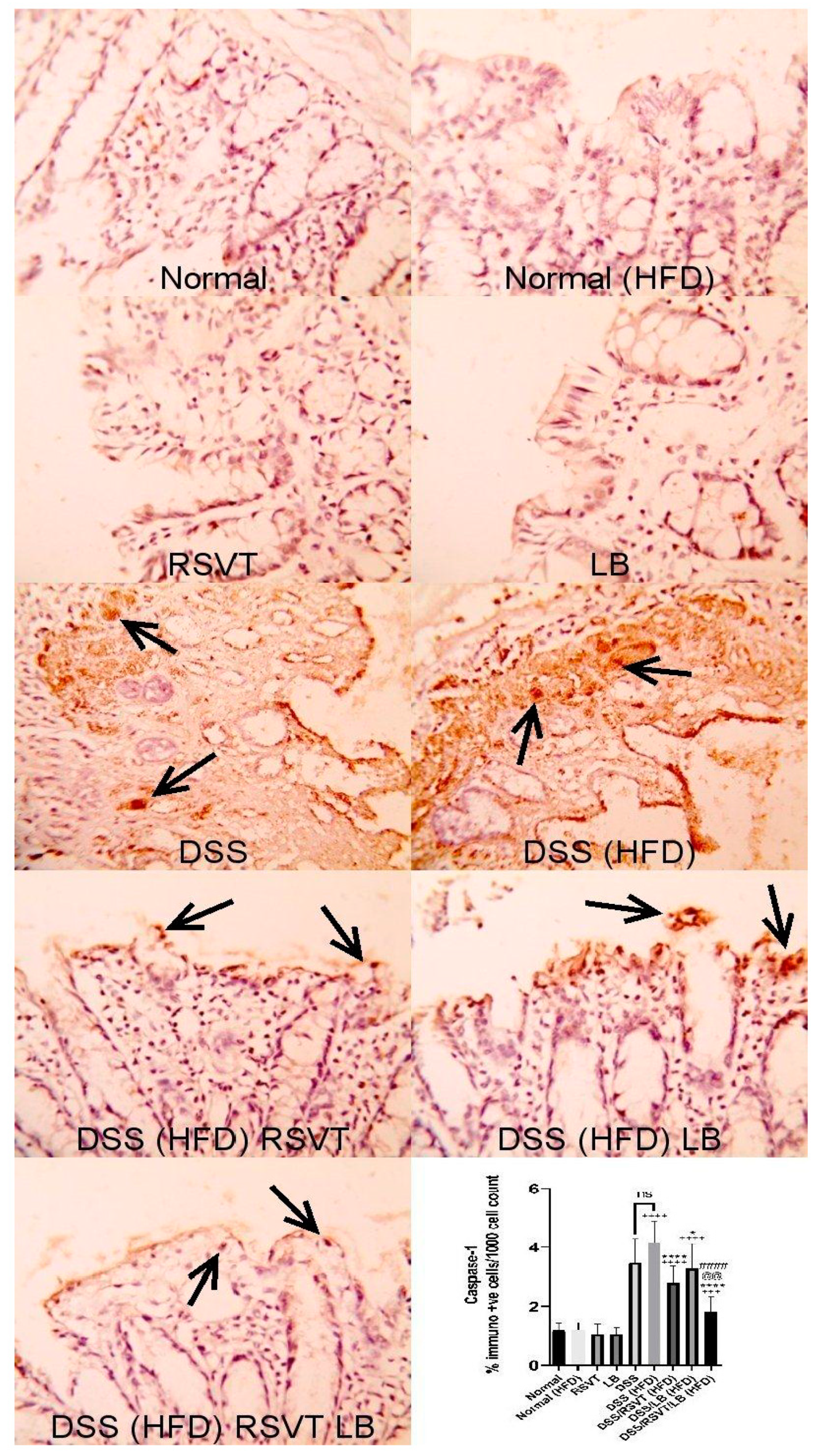 Pharmaceuticals 14 00341 g004