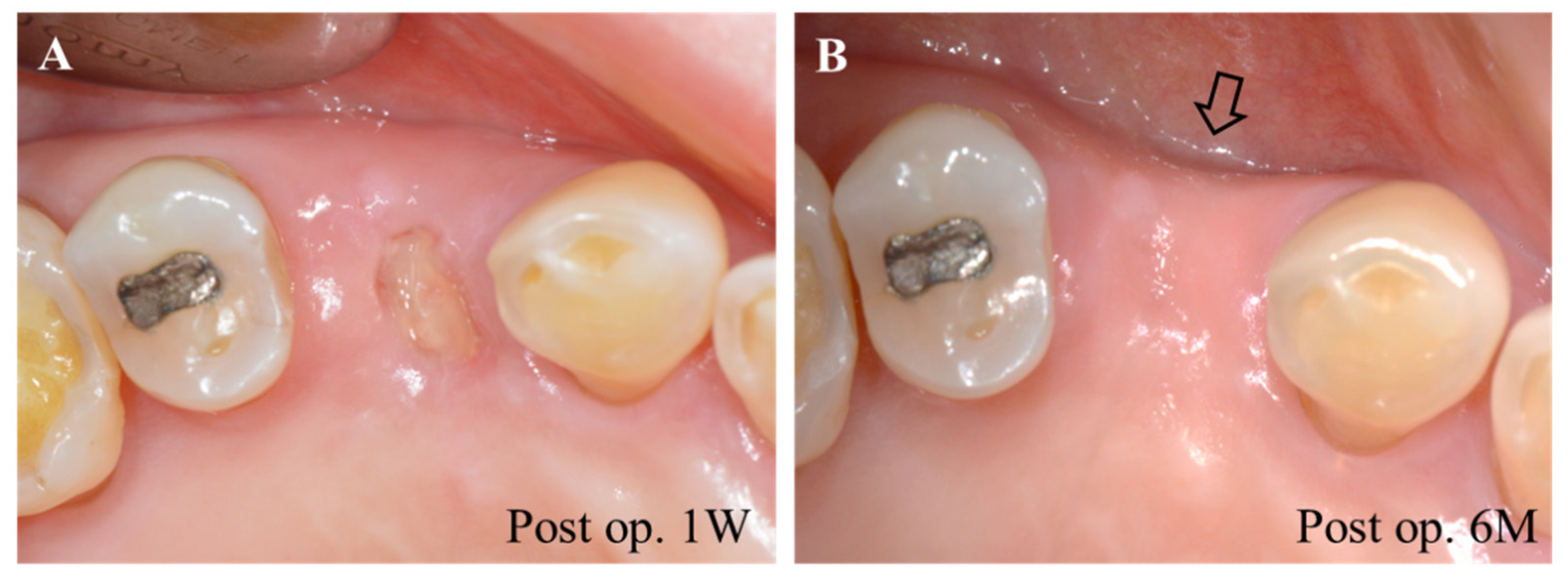 Pharmaceuticals 14 00456 g003