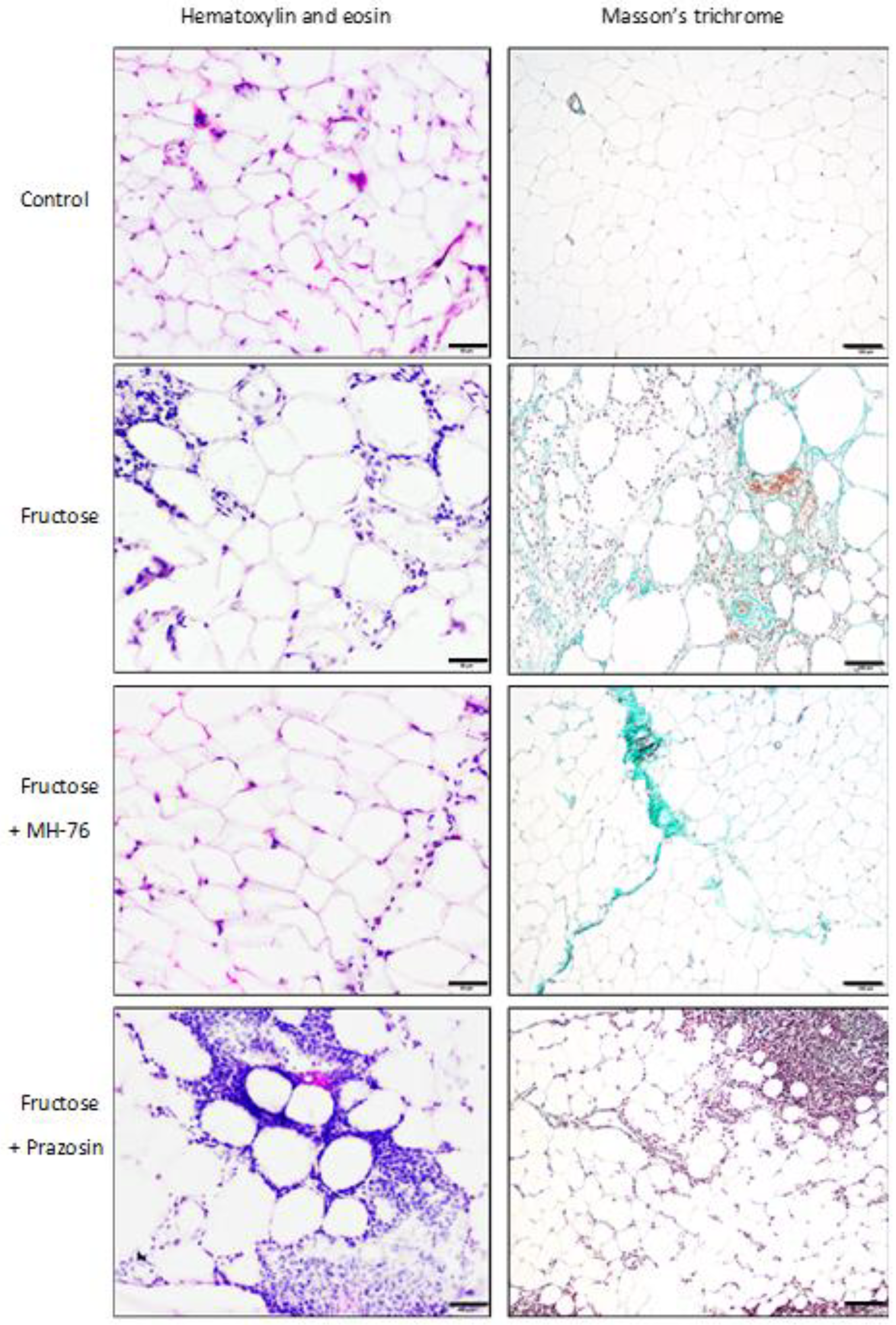 Pharmaceuticals 14 00477 g005