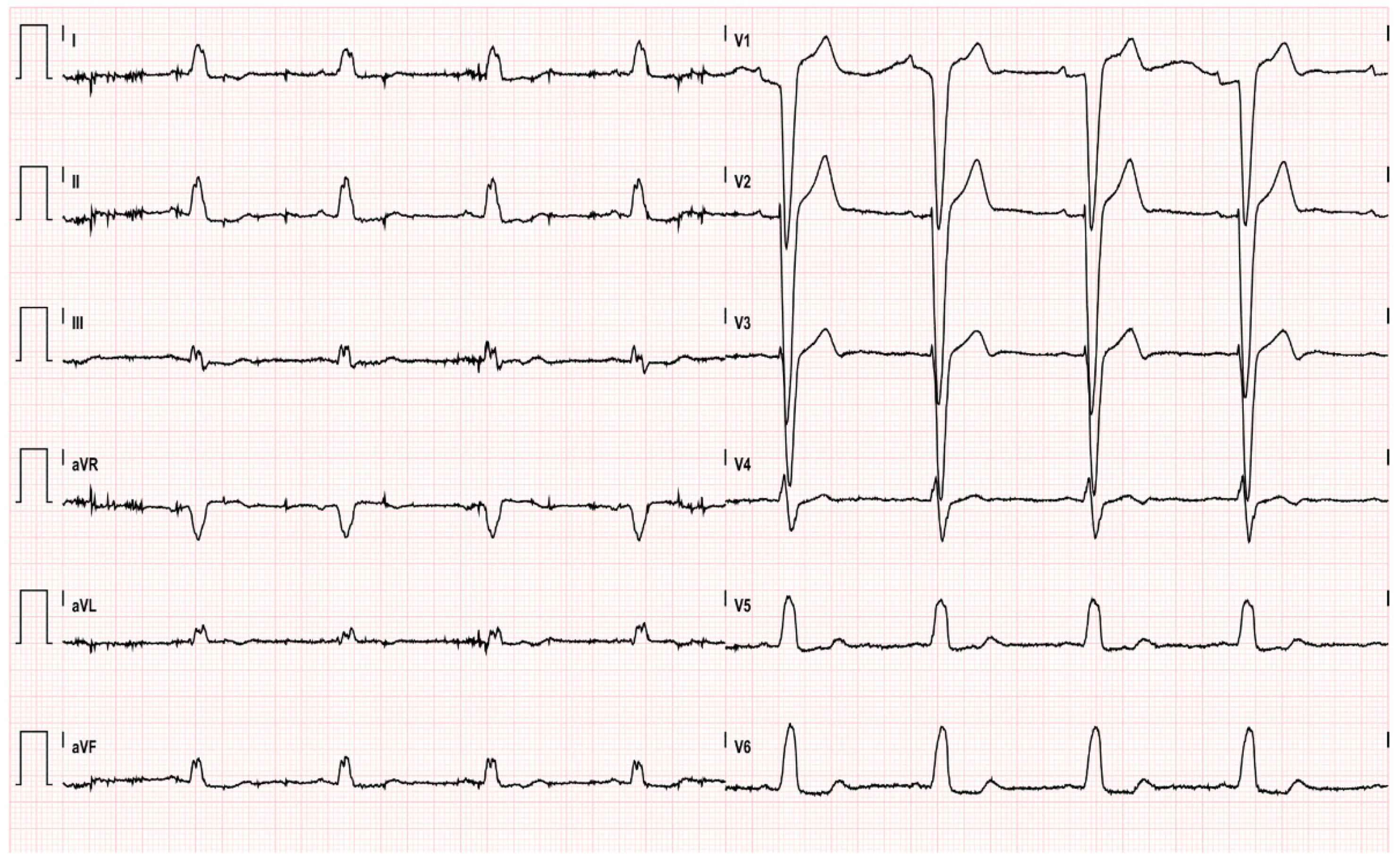 Pharmaceuticals 14 00563 g005 Pharmaceuticals 14 00563 g005
