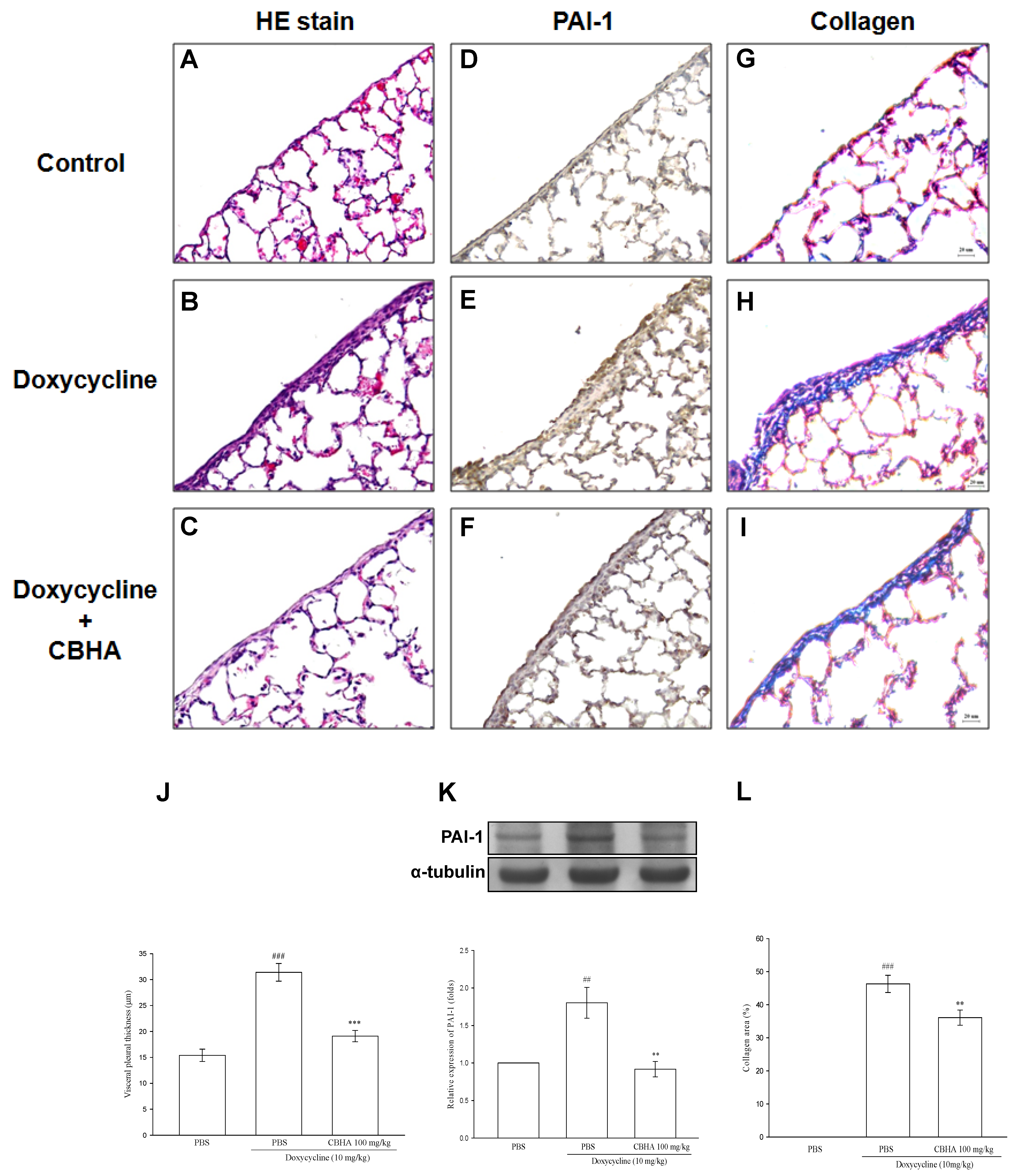 Pharmaceuticals 14 00585 g005
