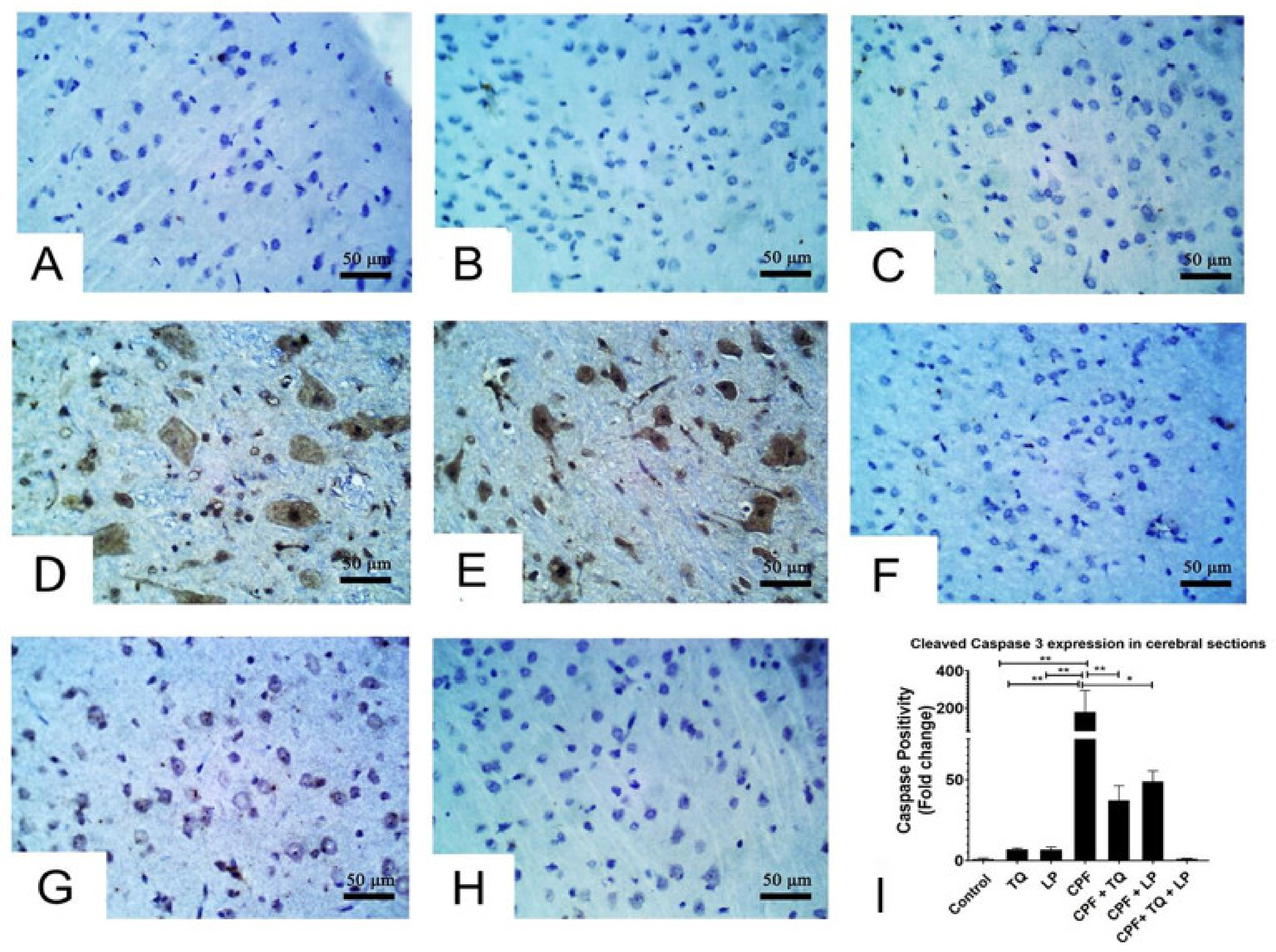 Pharmaceuticals 14 00940 g005