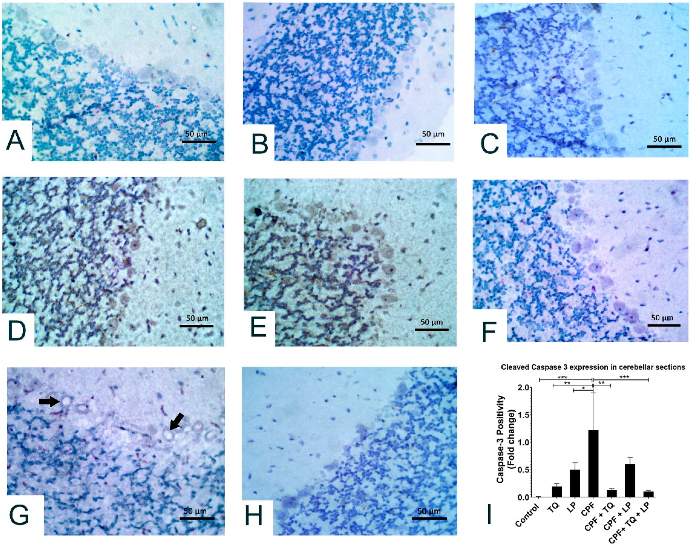 Pharmaceuticals 14 00940 g006