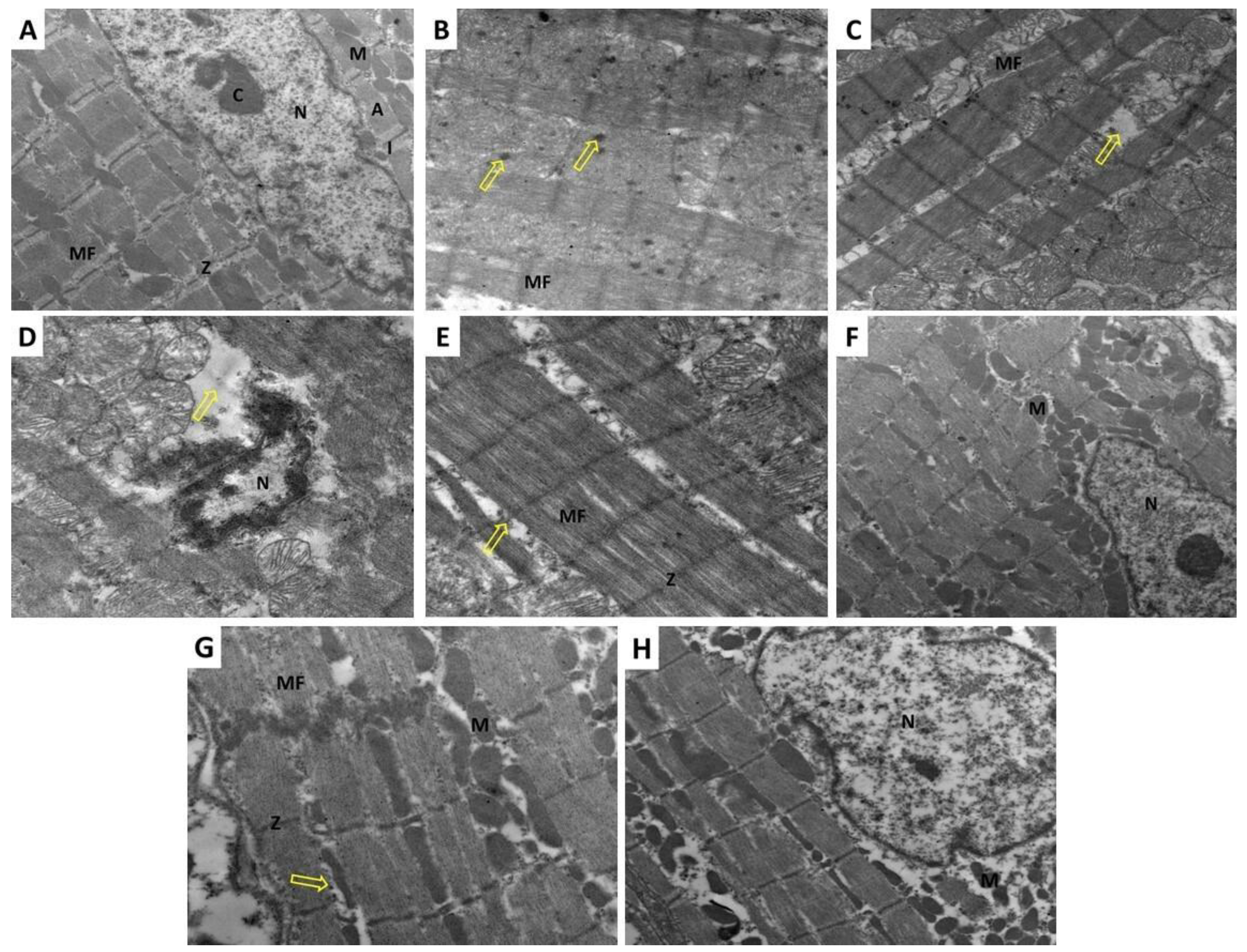 Pharmaceuticals 14 01188 g006