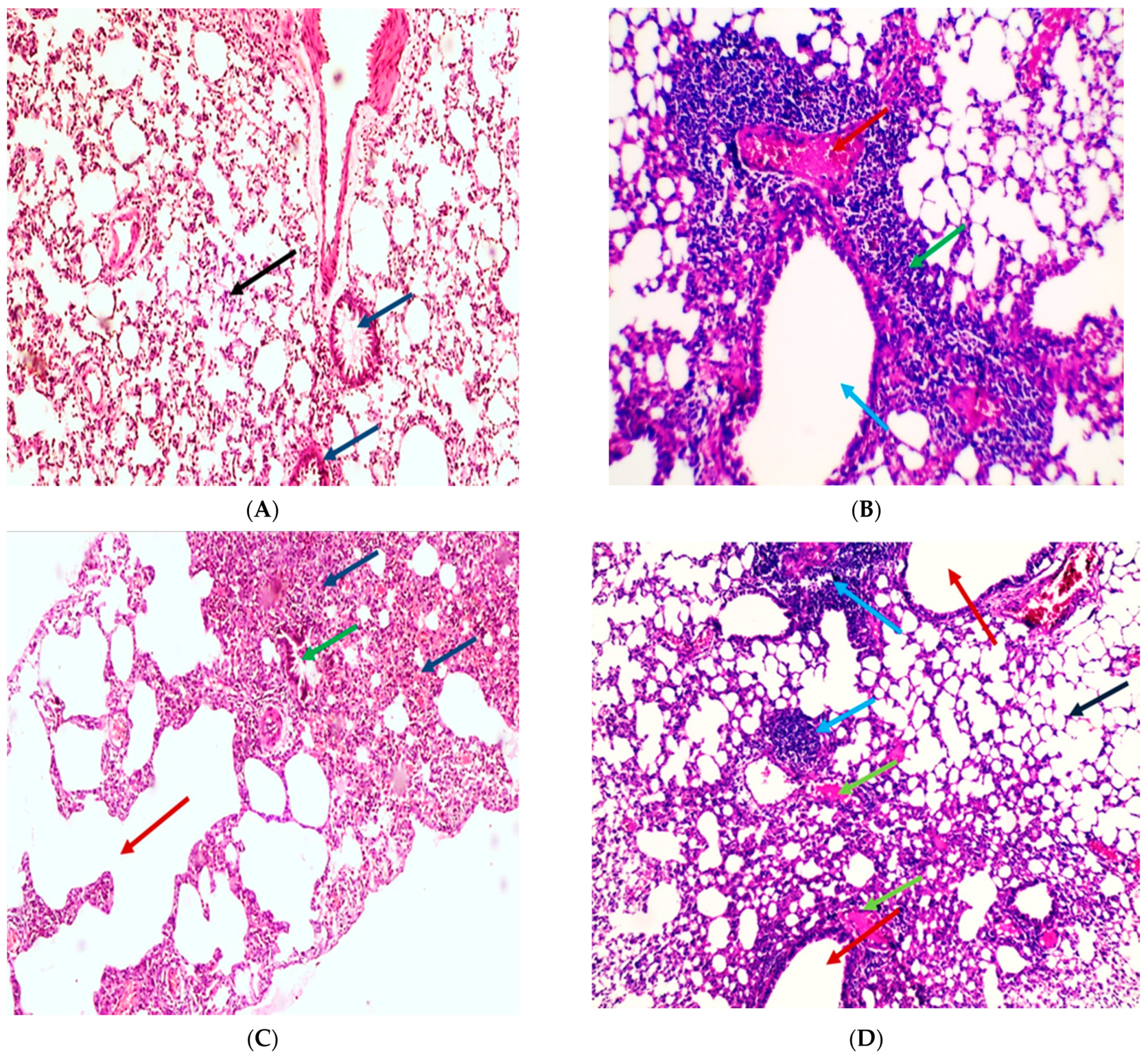 Pharmaceuticals 14 01313 g009a Pharmaceuticals 14 01313 g009a