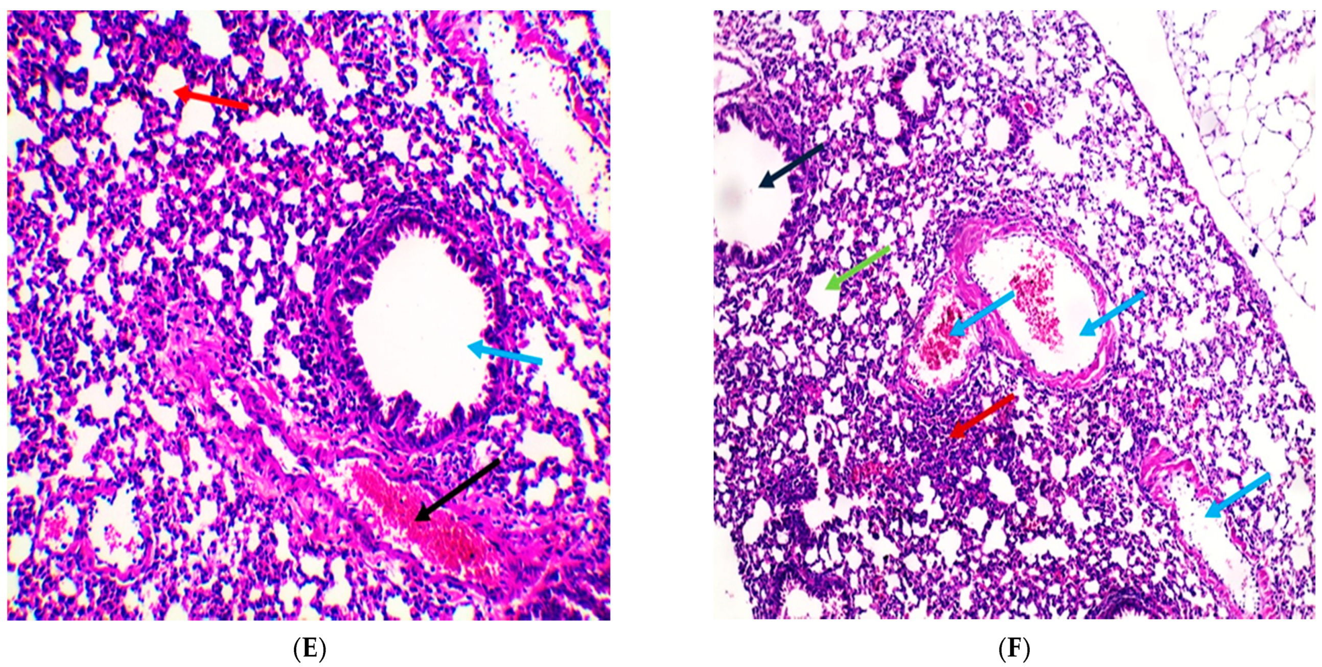 Pharmaceuticals 14 01313 g009b Pharmaceuticals 14 01313 g009b