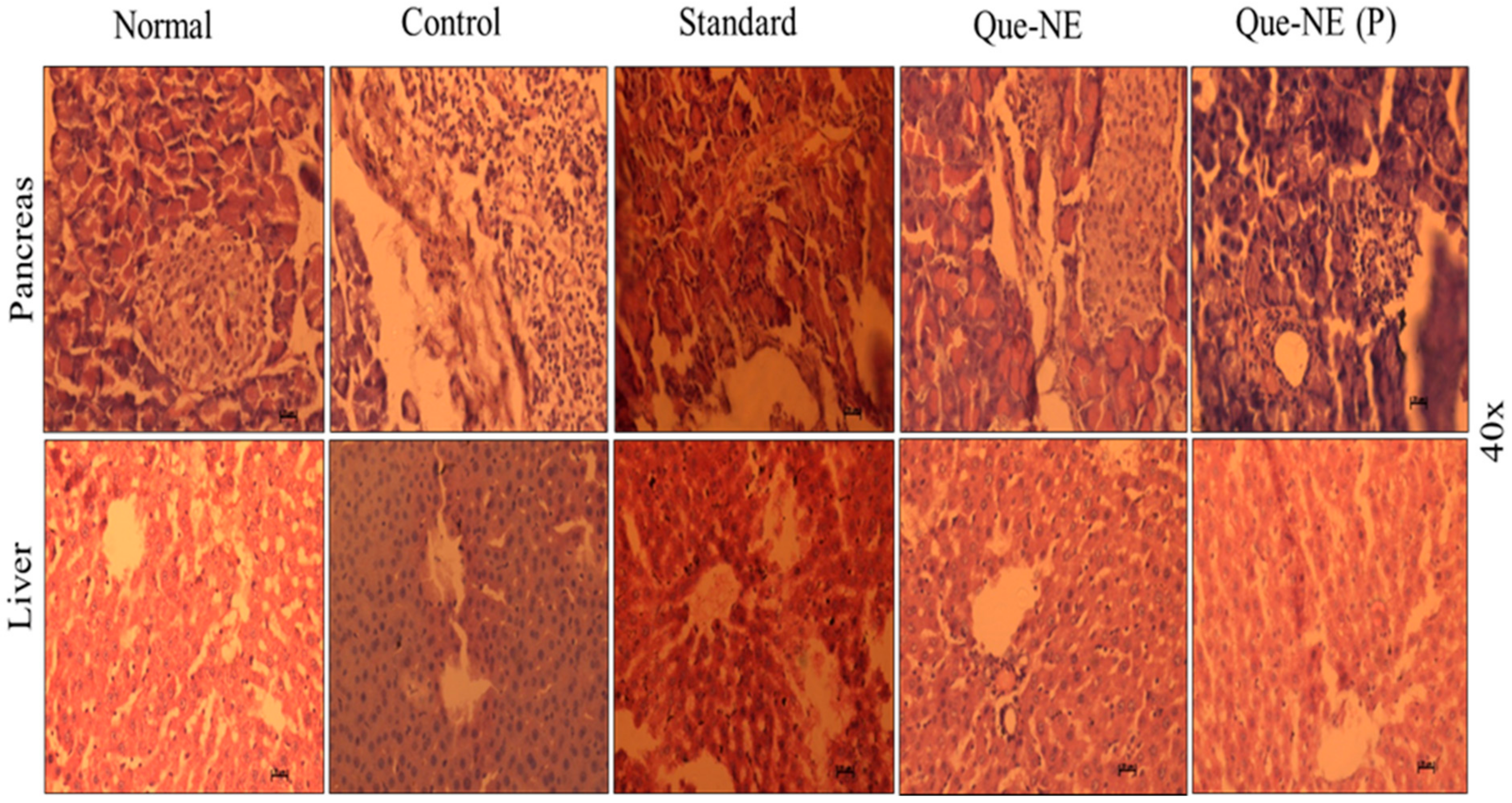 Pharmaceuticals 15 00070 g011
