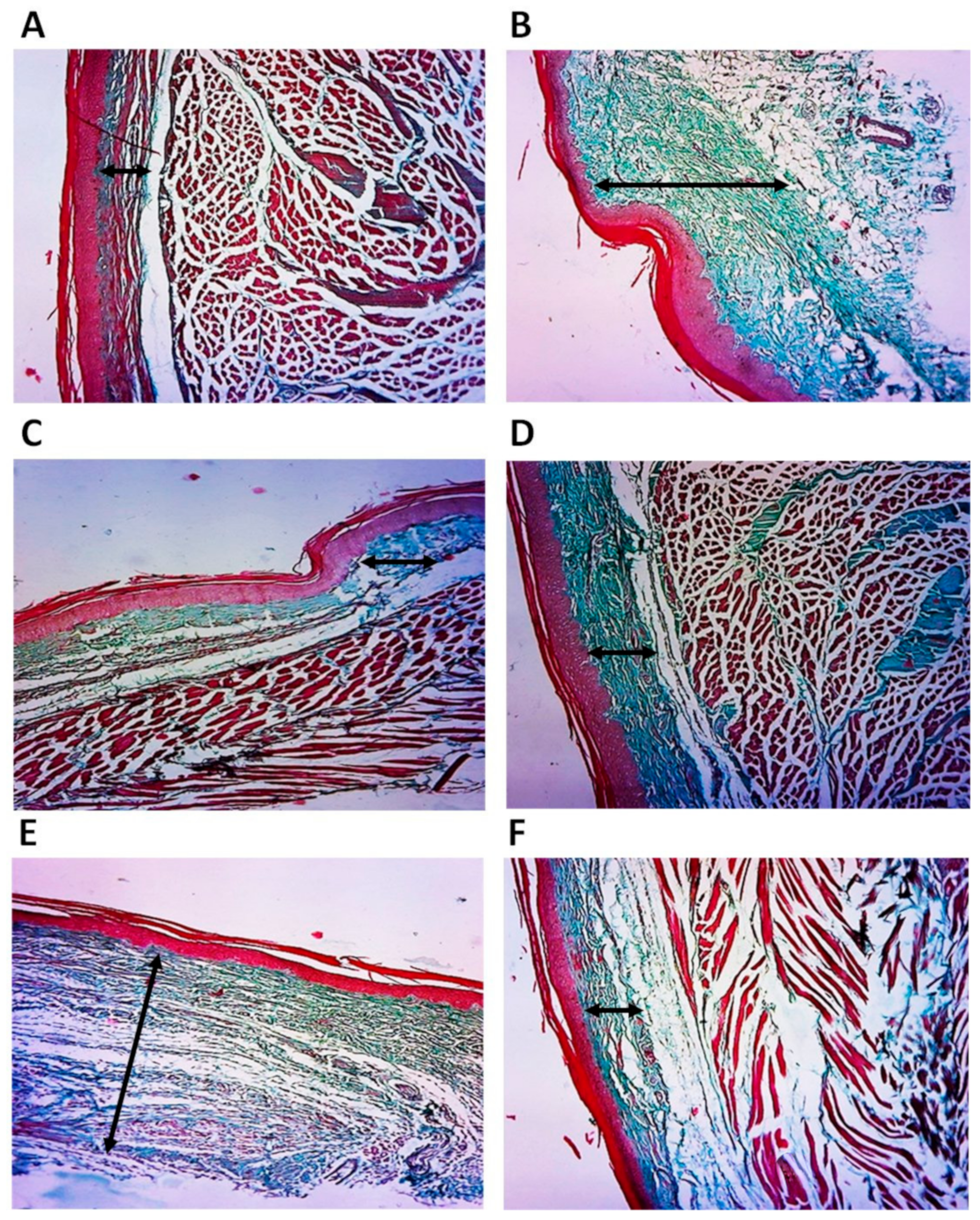 Pharmaceuticals 15 00282 g006