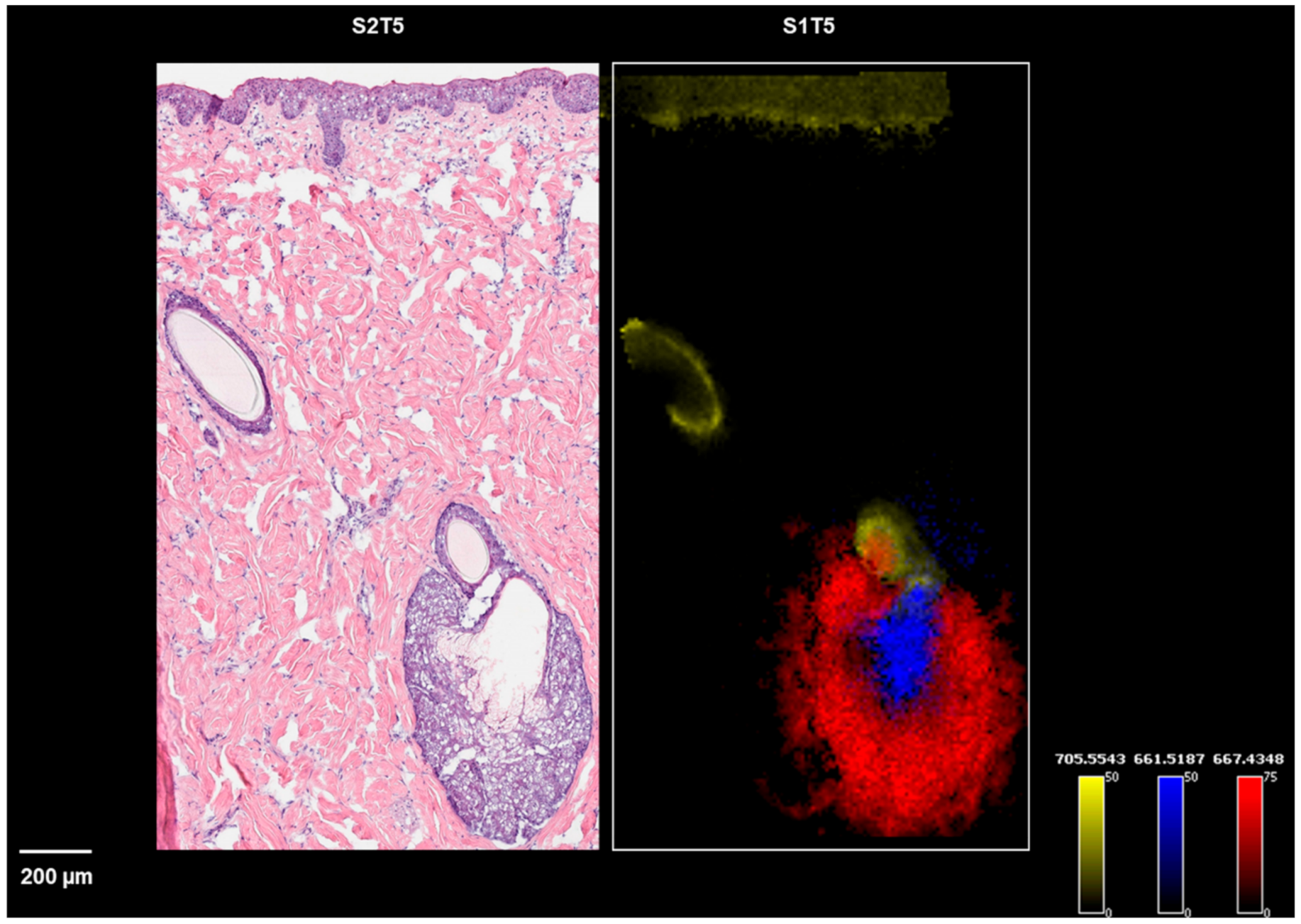 Pharmaceuticals 15 00411 g004
