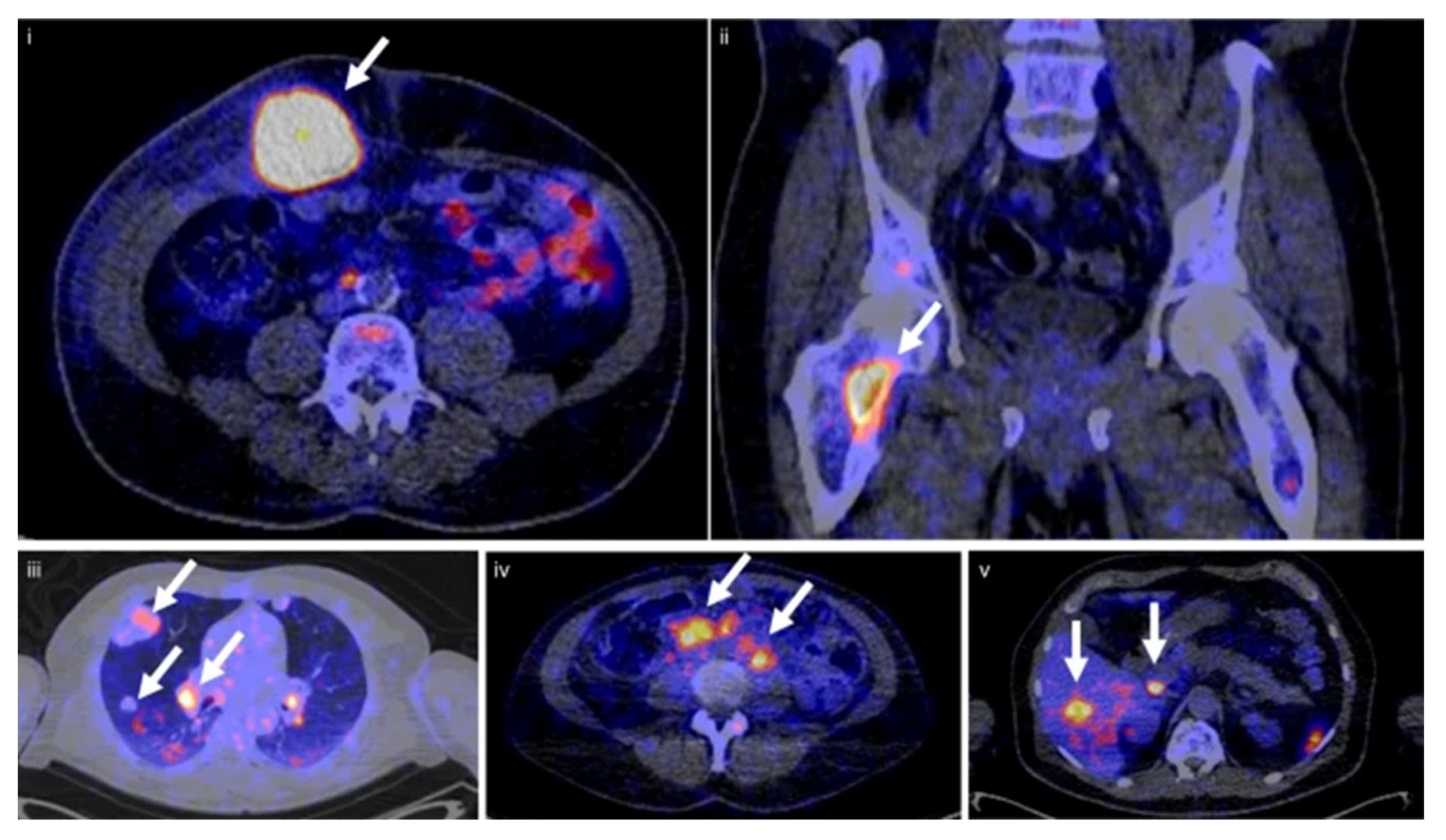Pharmaceuticals 15 00747 g004