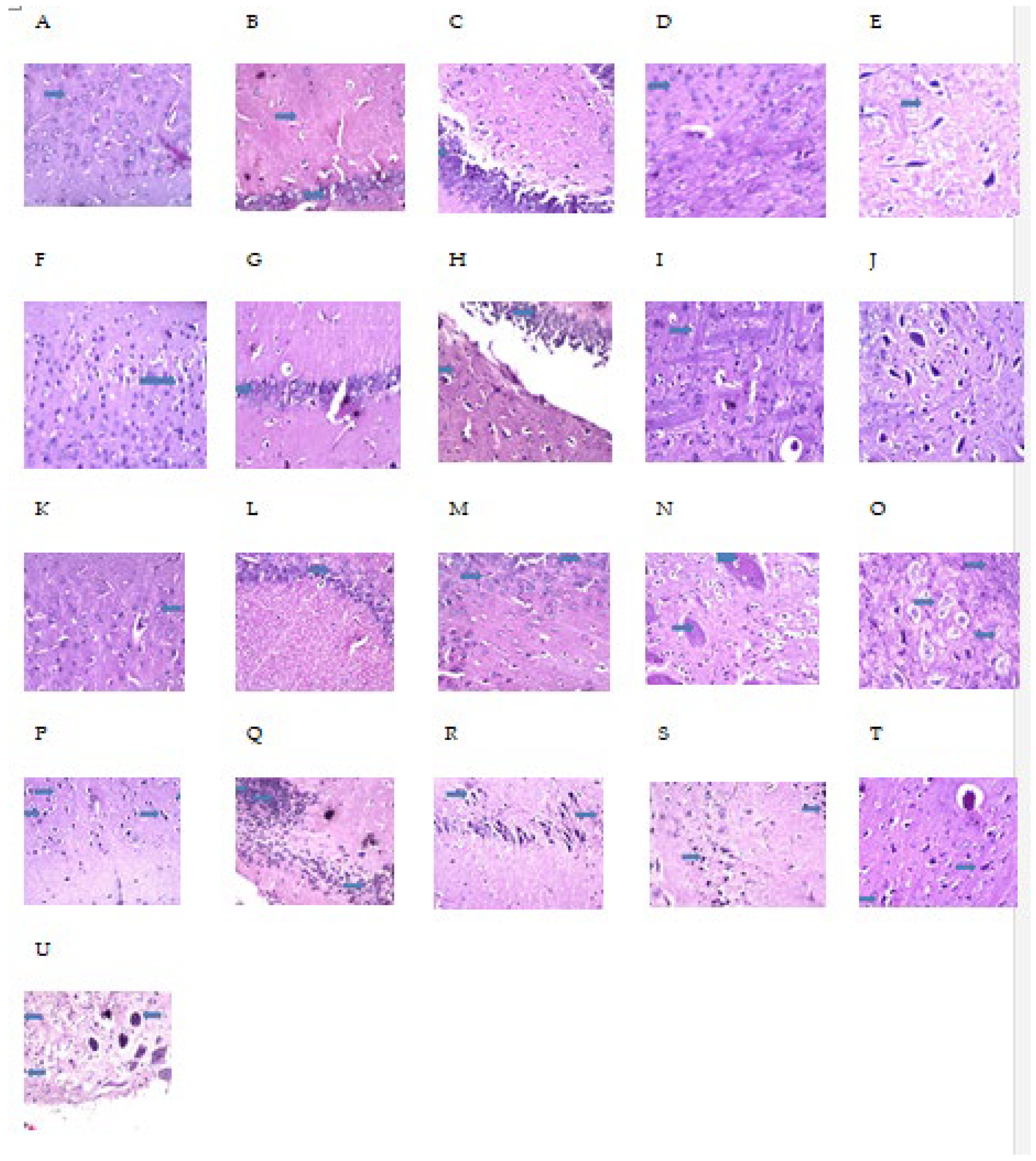 Pharmaceuticals 15 01012 g011 Pharmaceuticals 15 01012 g011