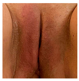 Pharmaceuticals 15 01571 i004