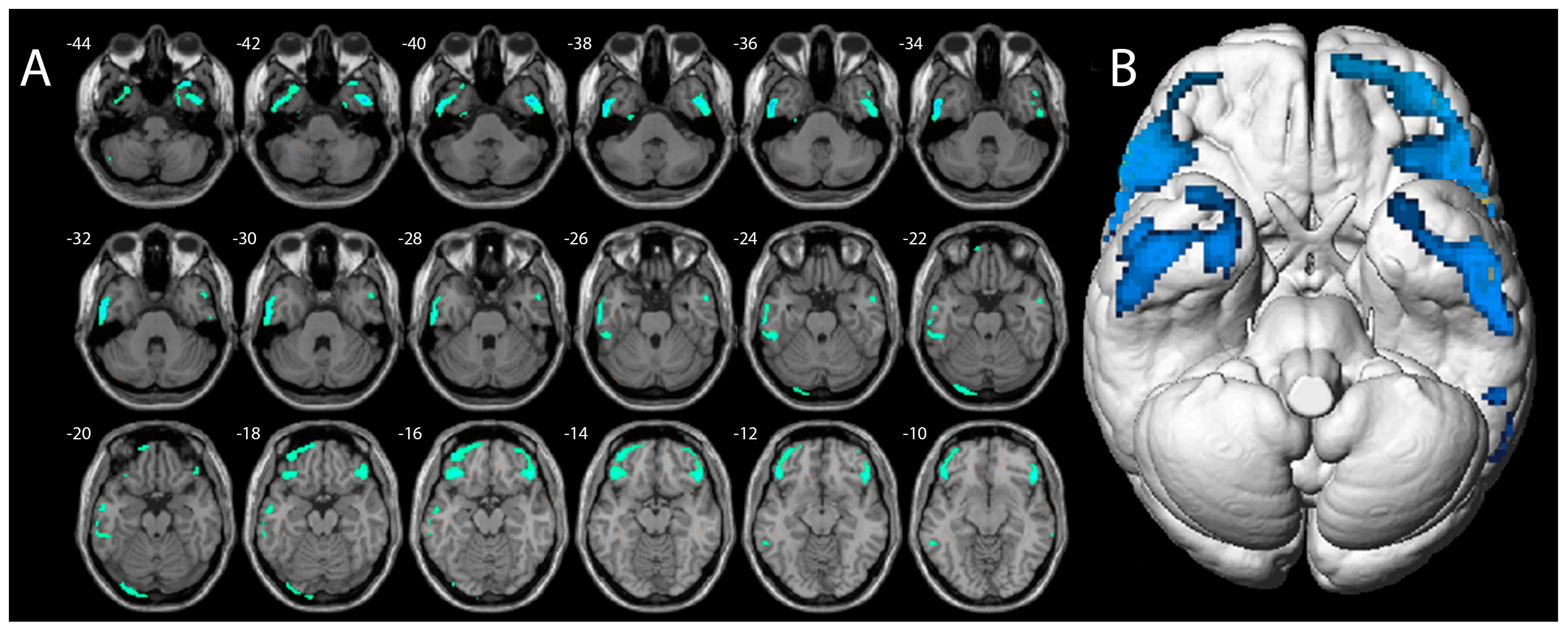 Pharmaceuticals 17 00452 g003 Pharmaceuticals 17 00452 g003