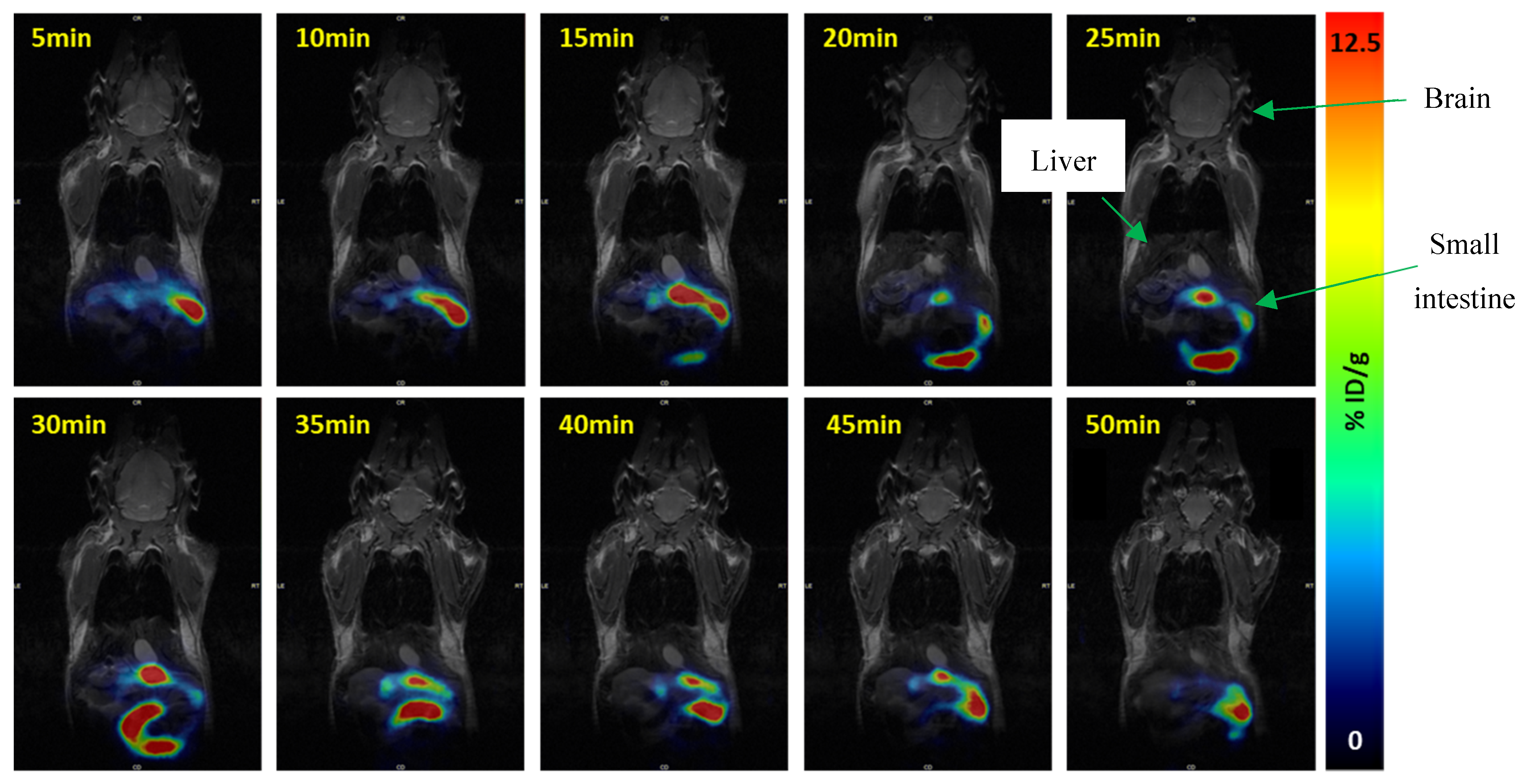 Pharmaceuticals 17 00474 g006