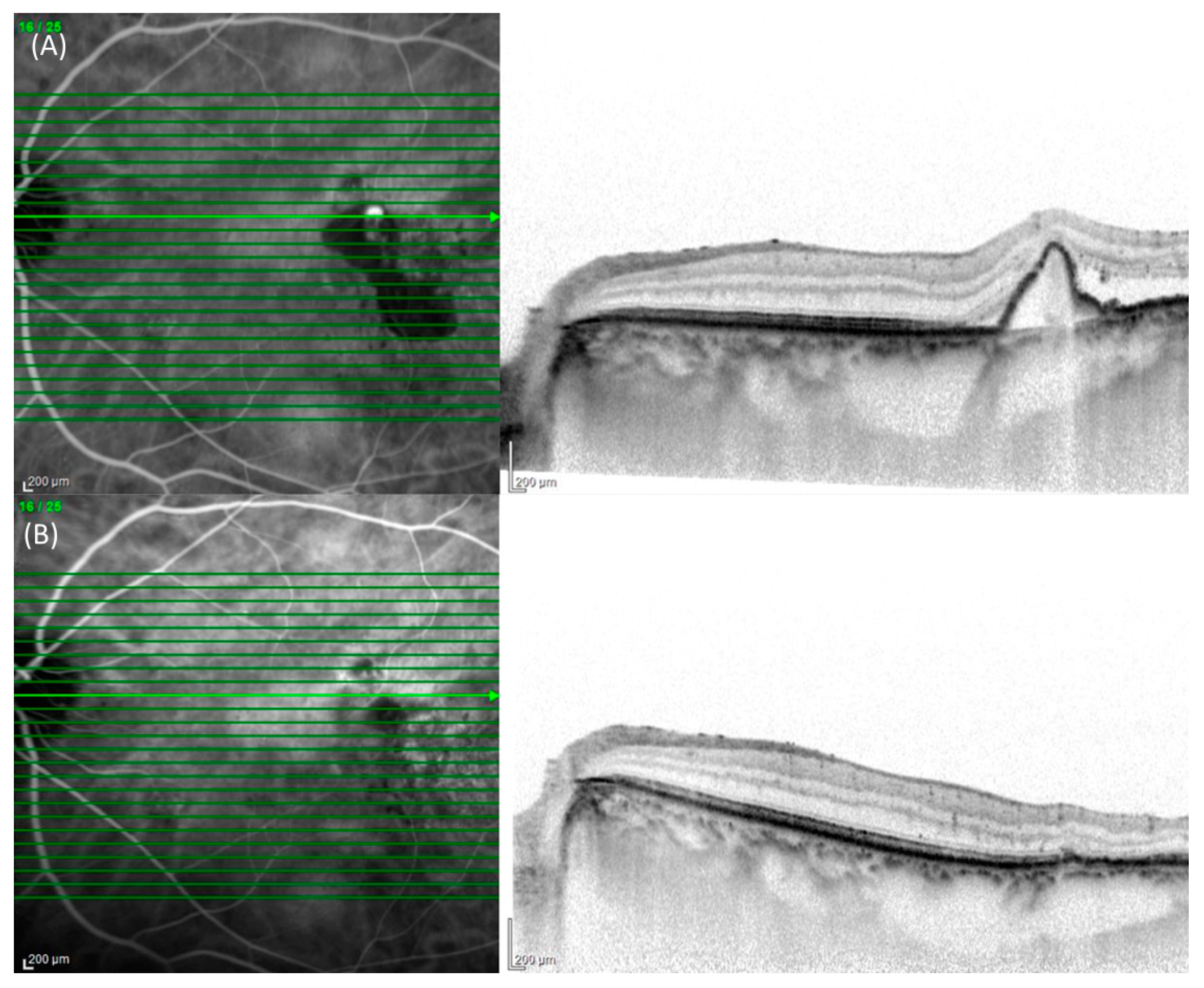 Pharmaceuticals 17 00687 g003