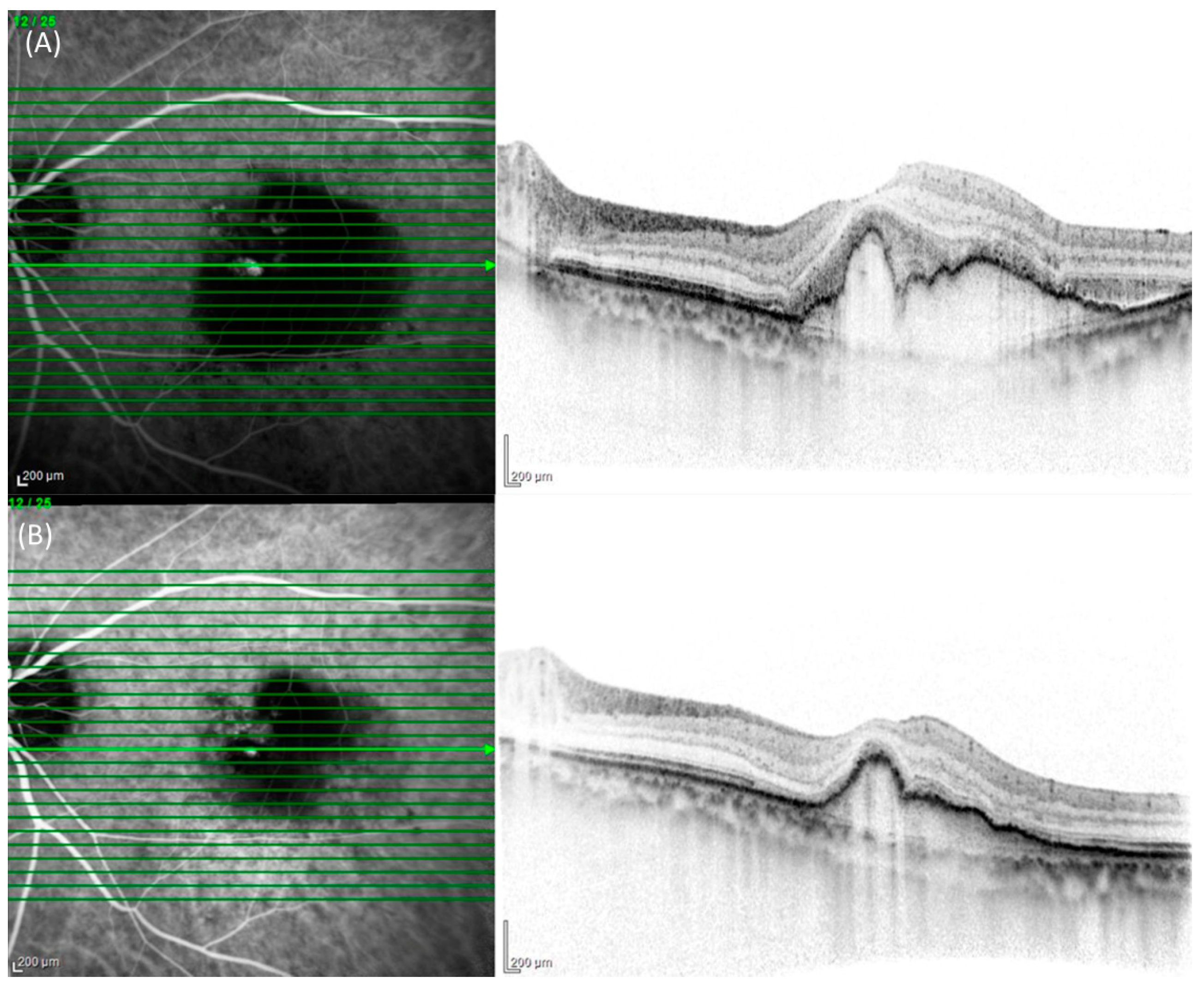 Pharmaceuticals 17 00687 g004