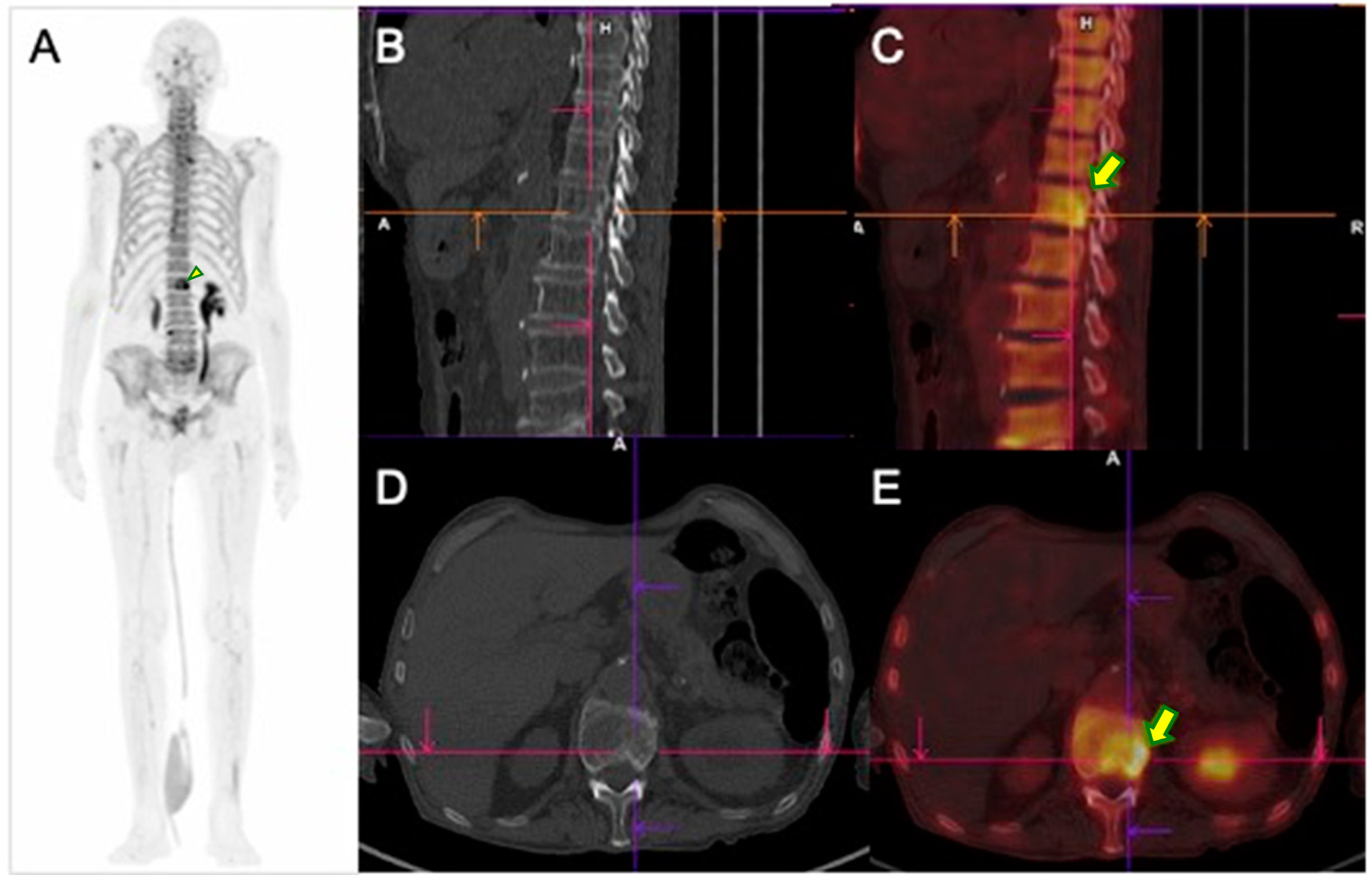 Pharmaceuticals 17 01483 g005