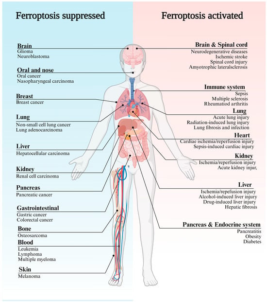 Ferroptosis, a Distinct Form of Cell Death, and Research Progress on ...