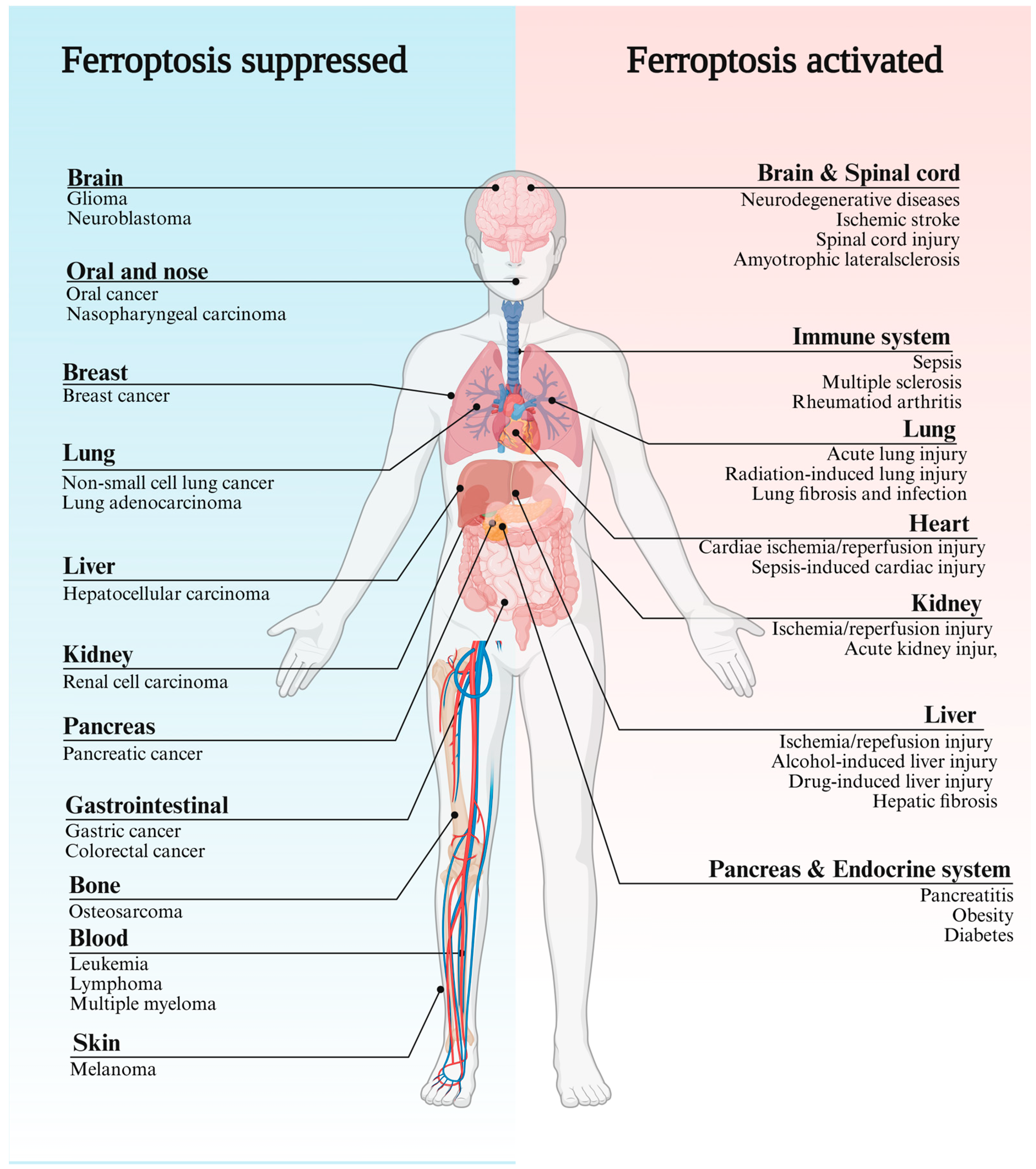 Ferroptosis, a Distinct Form of Cell Death, and Research Progress on ...
